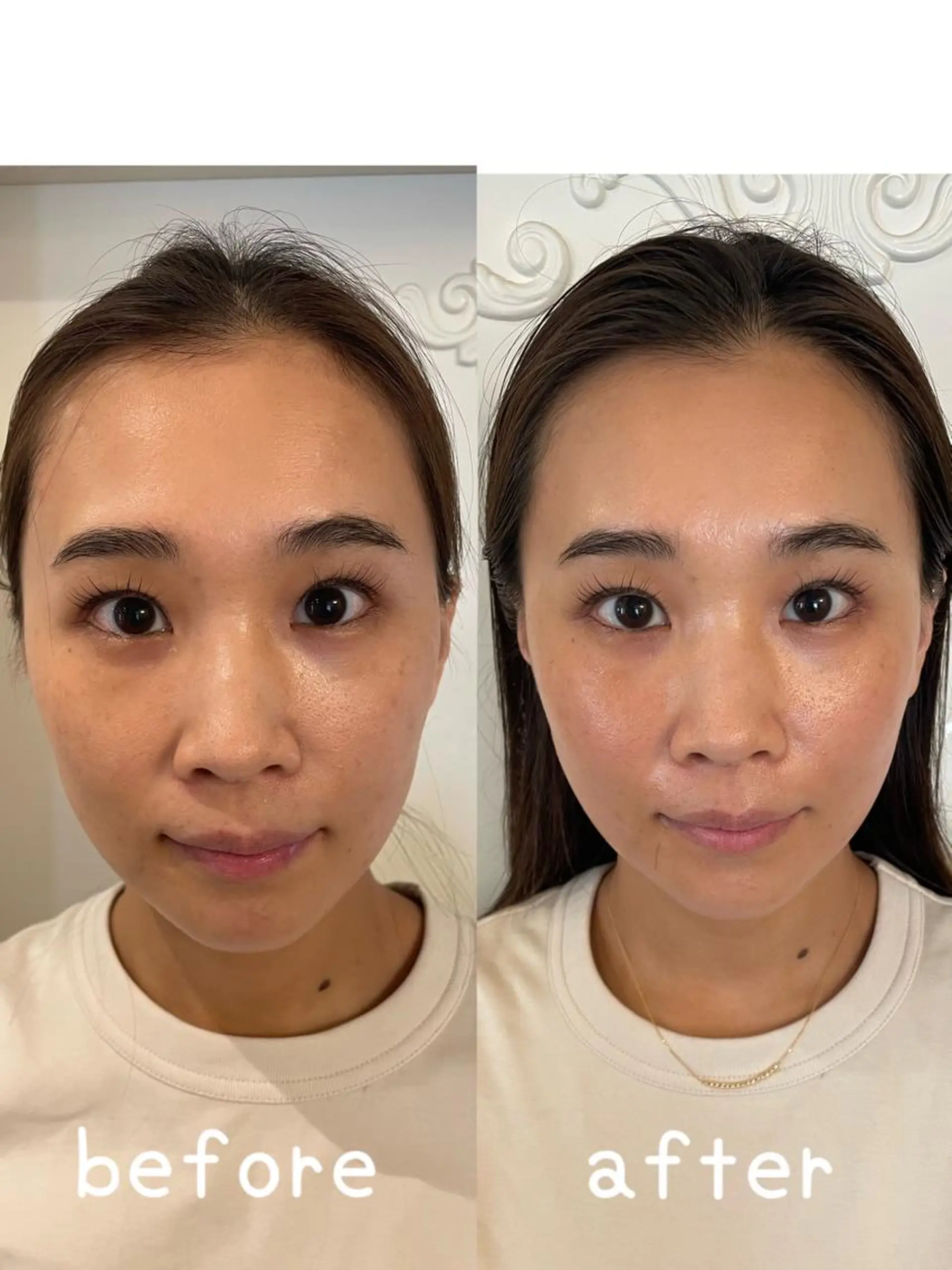 美容鍼灸サロン mahoroba院長のエステ・リラクイメージ