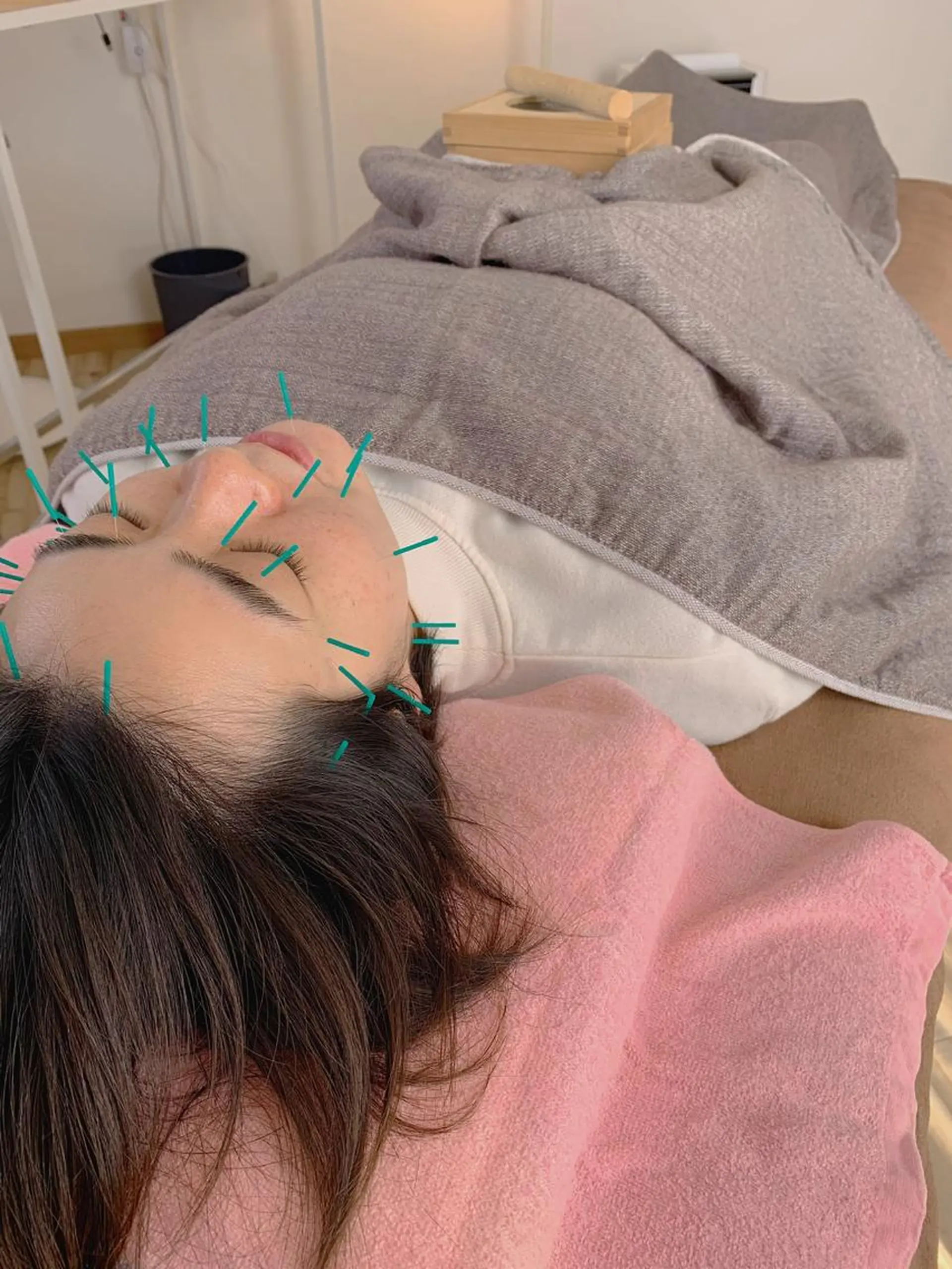 はりきゅうサロン Lagomのエステ・リラクイメージ