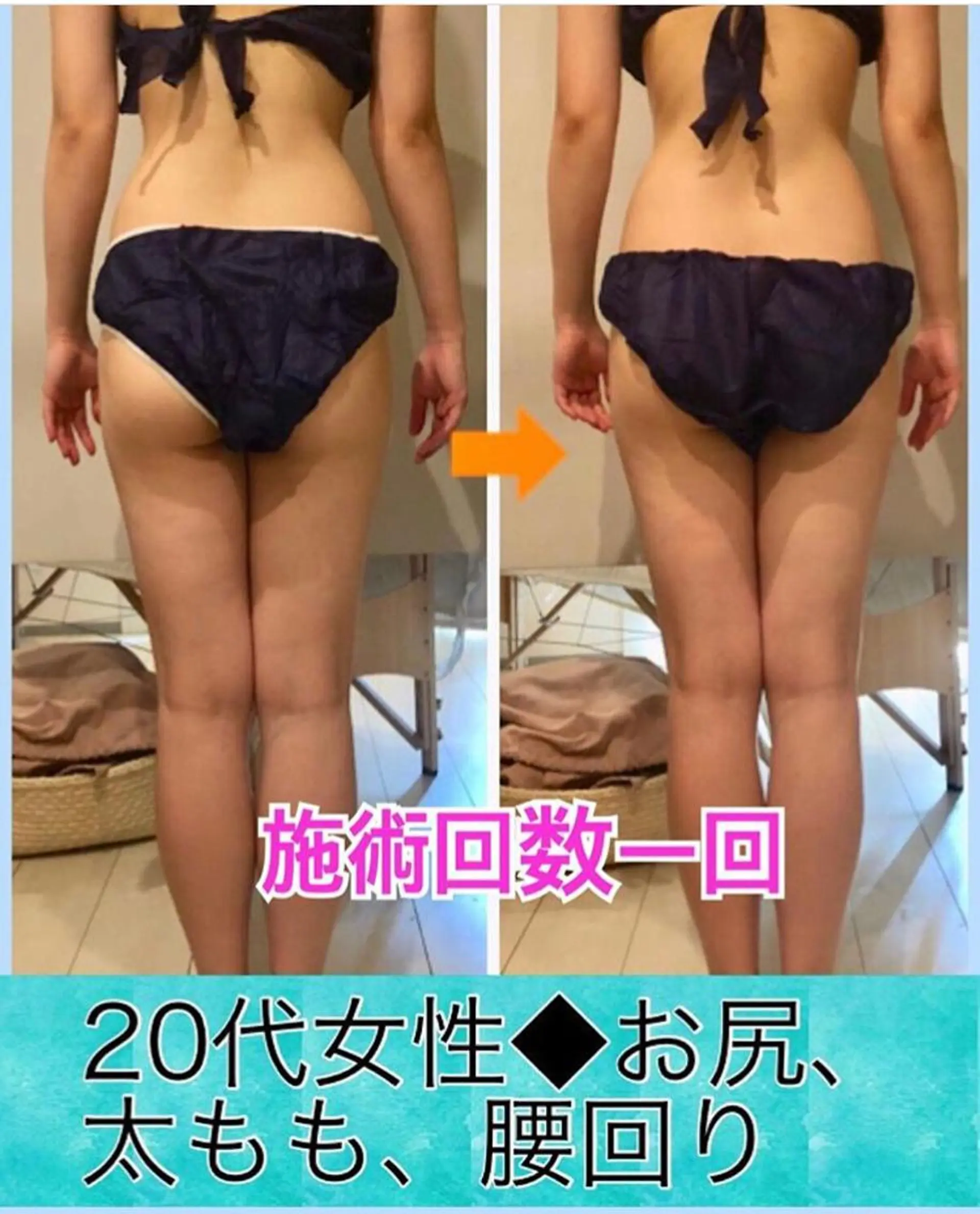 ショート カラー パーマ ヘアアレンジ メンズ キッズ ネイル マツエク・マツパ ‍痩身＆ボディ 結果出し🌟丹野のエステ・リラクイメージ