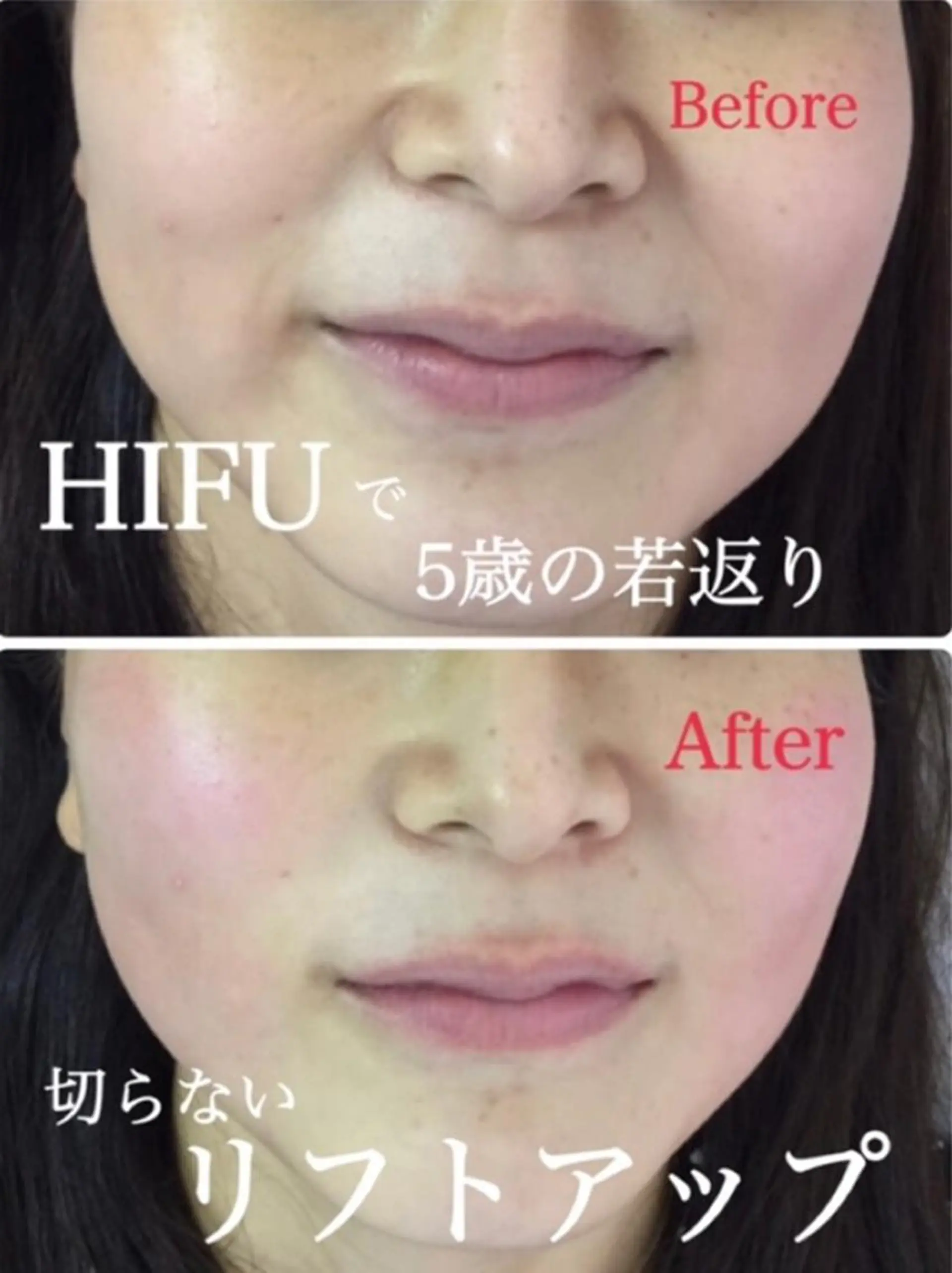 肌質改善サロンChouChou所属・肌質改善サロン chouchouのエステ・リラクイメージ