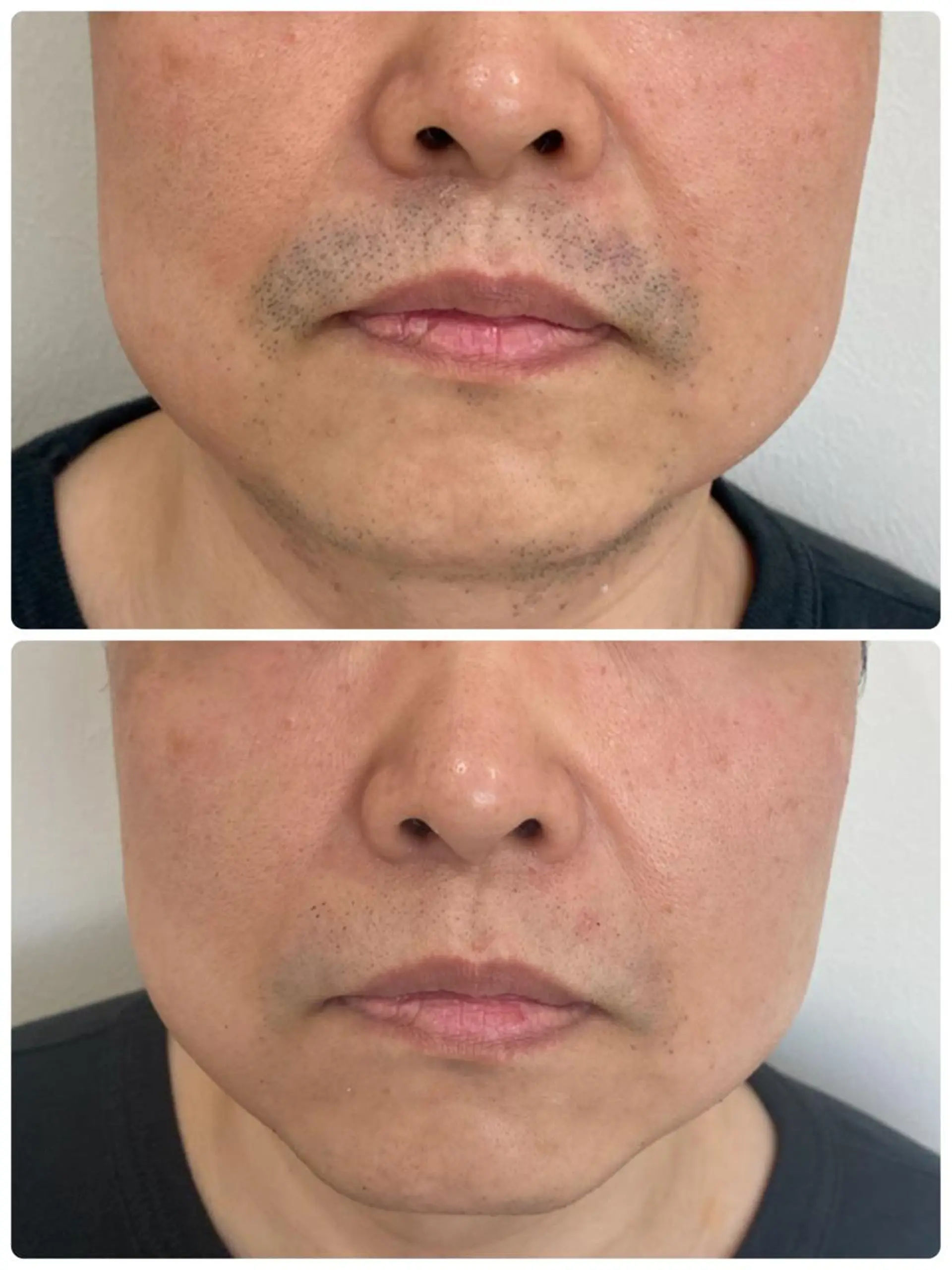 メンズ hyakutake itsumiのネイルデザイン