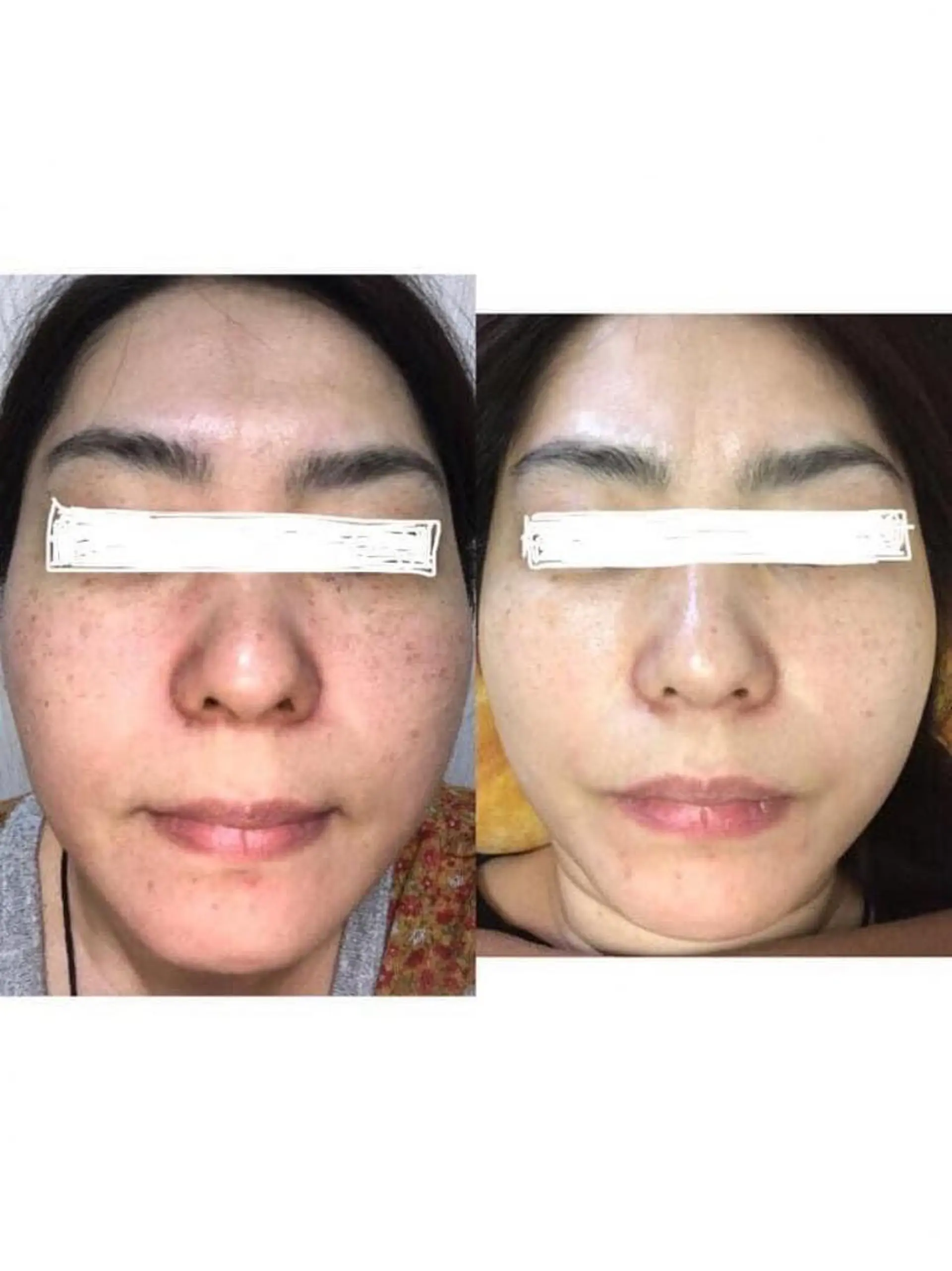 エステ 仲澤 千春のその他イメージ