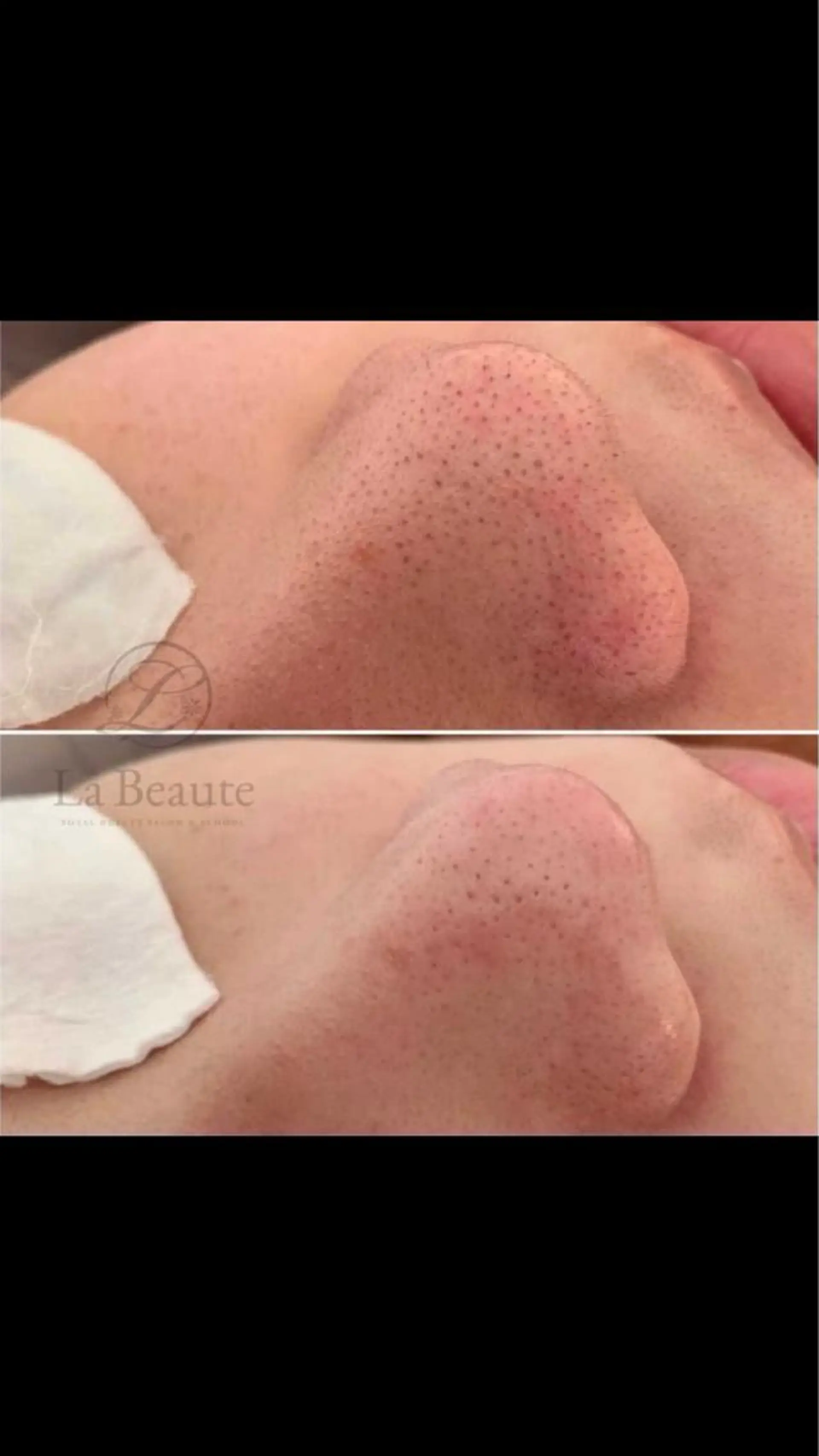 エステ 最速 毛穴シミ改善 いくえのその他イメージ