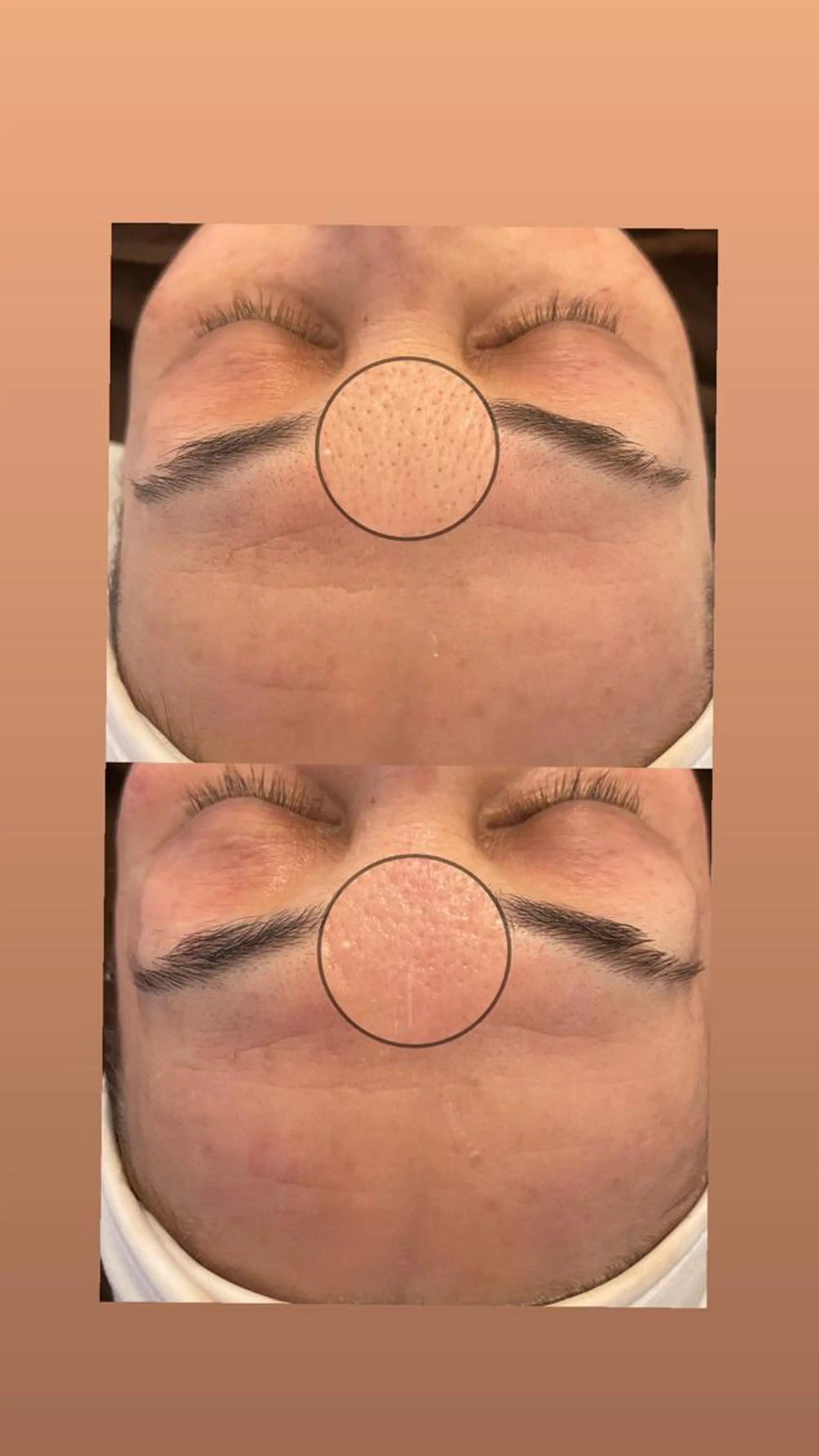 amu nail. RINAのネイルデザイン