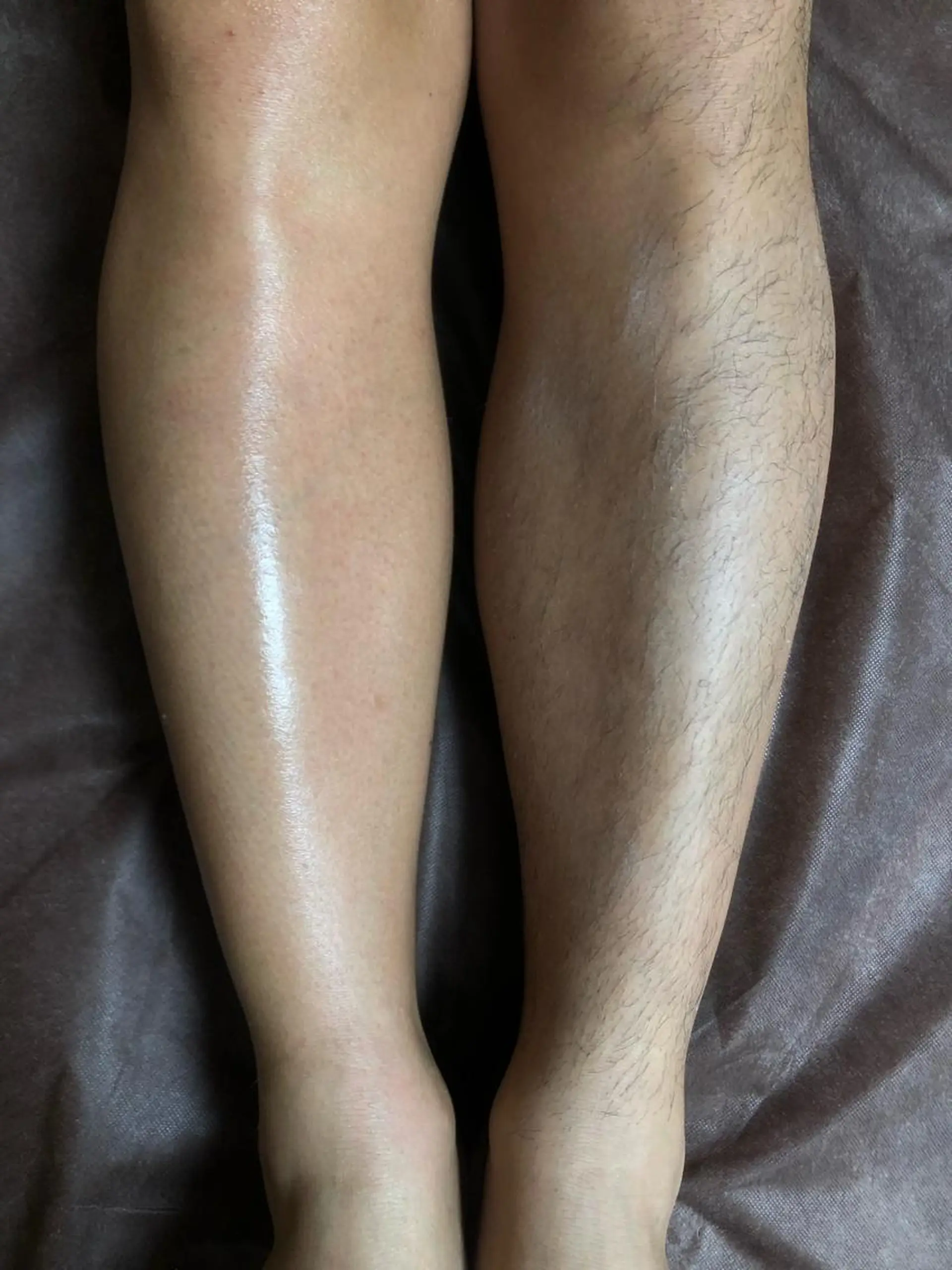 メンズ 脱毛 ブラジリアン☆WAX 🎖🌚YUKI🌚のエステ・リラクイメージ