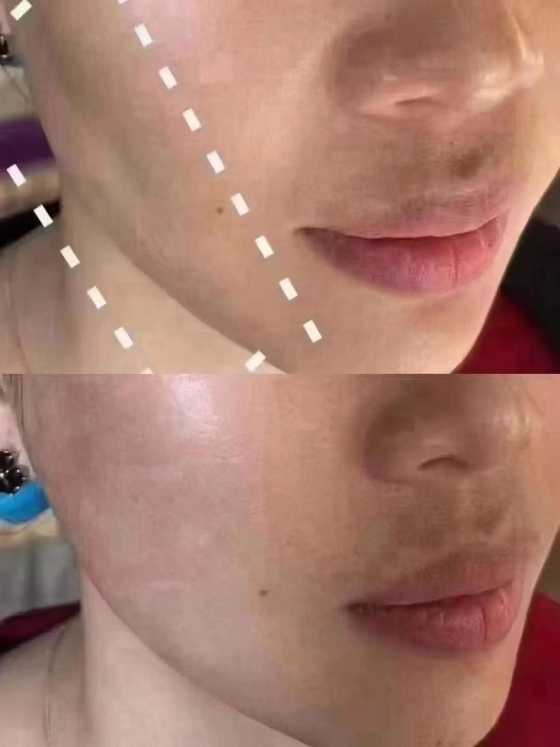 ショート カラー パーマ ネイル マツエク・マツパ UVネイル エステ aliaハーブ水光店 エステティシャン募集のエステ・リラクイメージ