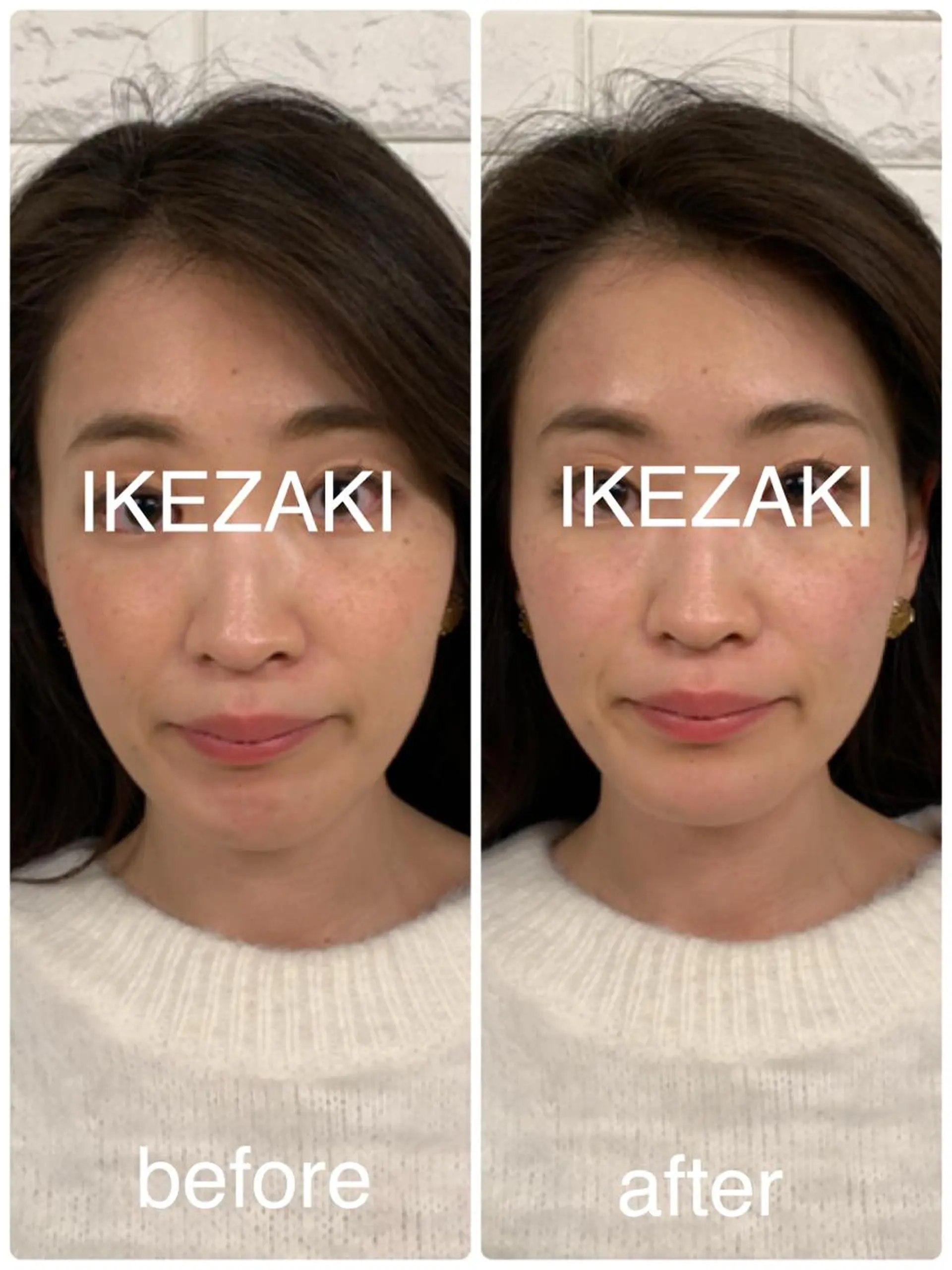 美容鍼 IKEZAKIのエステ・リラクイメージ