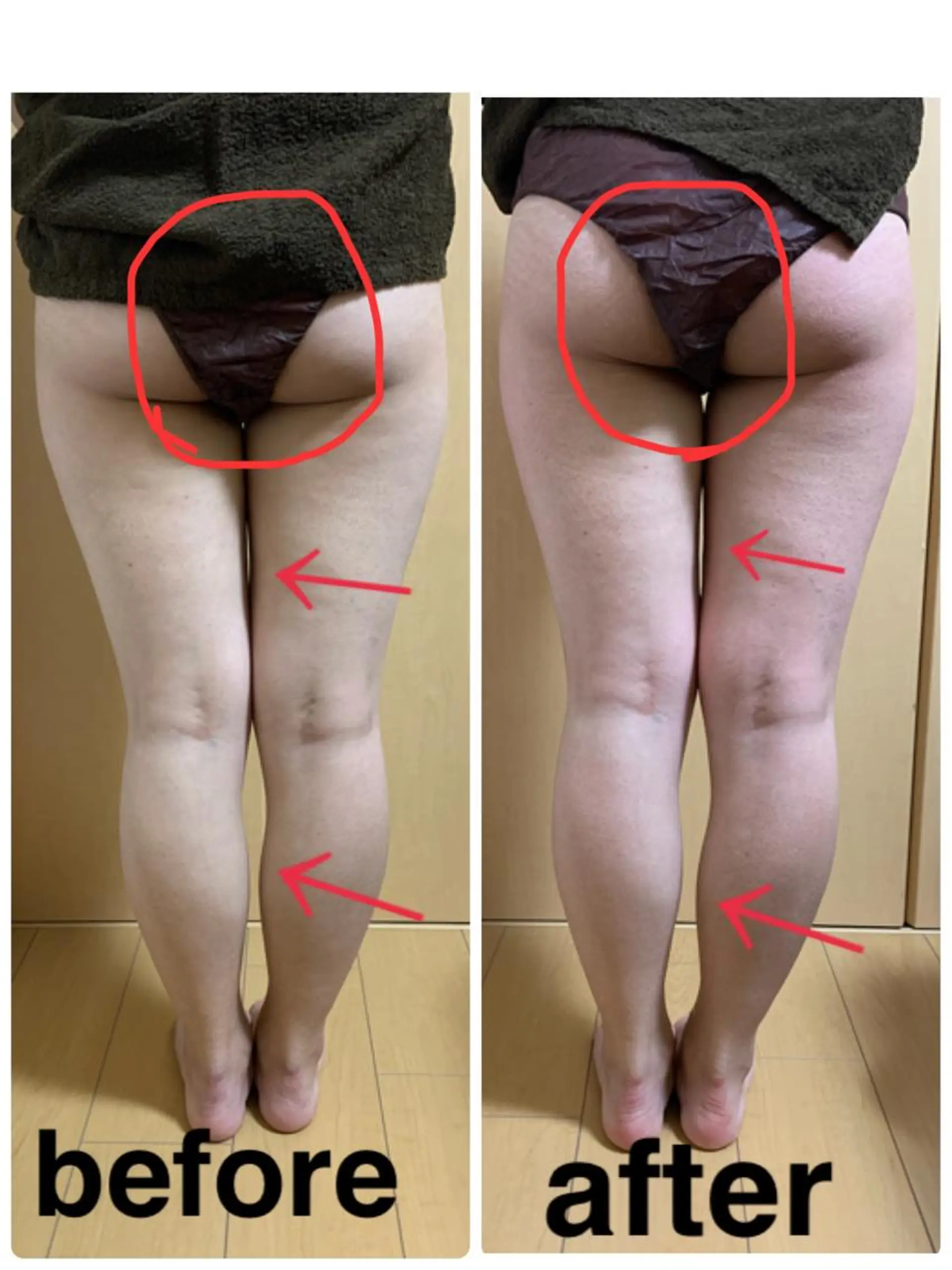 ネイル エステ リラク 痩身/脱毛/ネイル HARUKAのエステ・リラクイメージ