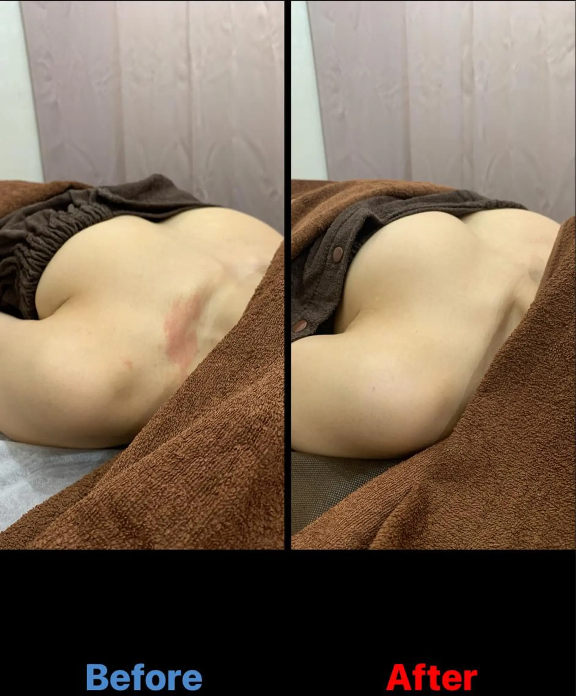 エステ 毛穴改善/脱毛 ネイル 川上久仁子のエステ・リラクイメージ