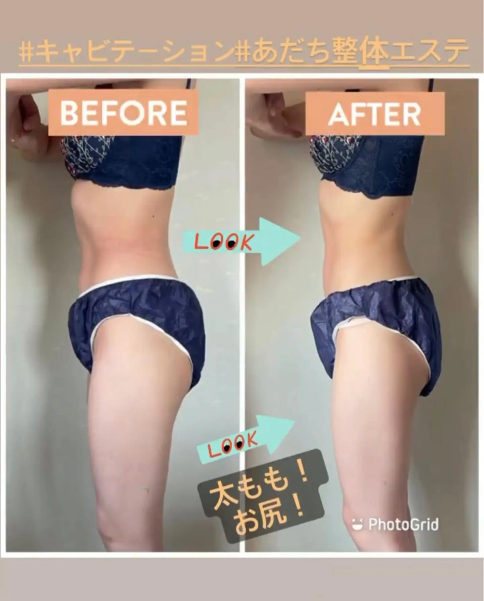 あだち整体エステ 首肩背中のゆるめぐのエステ・リラクイメージ