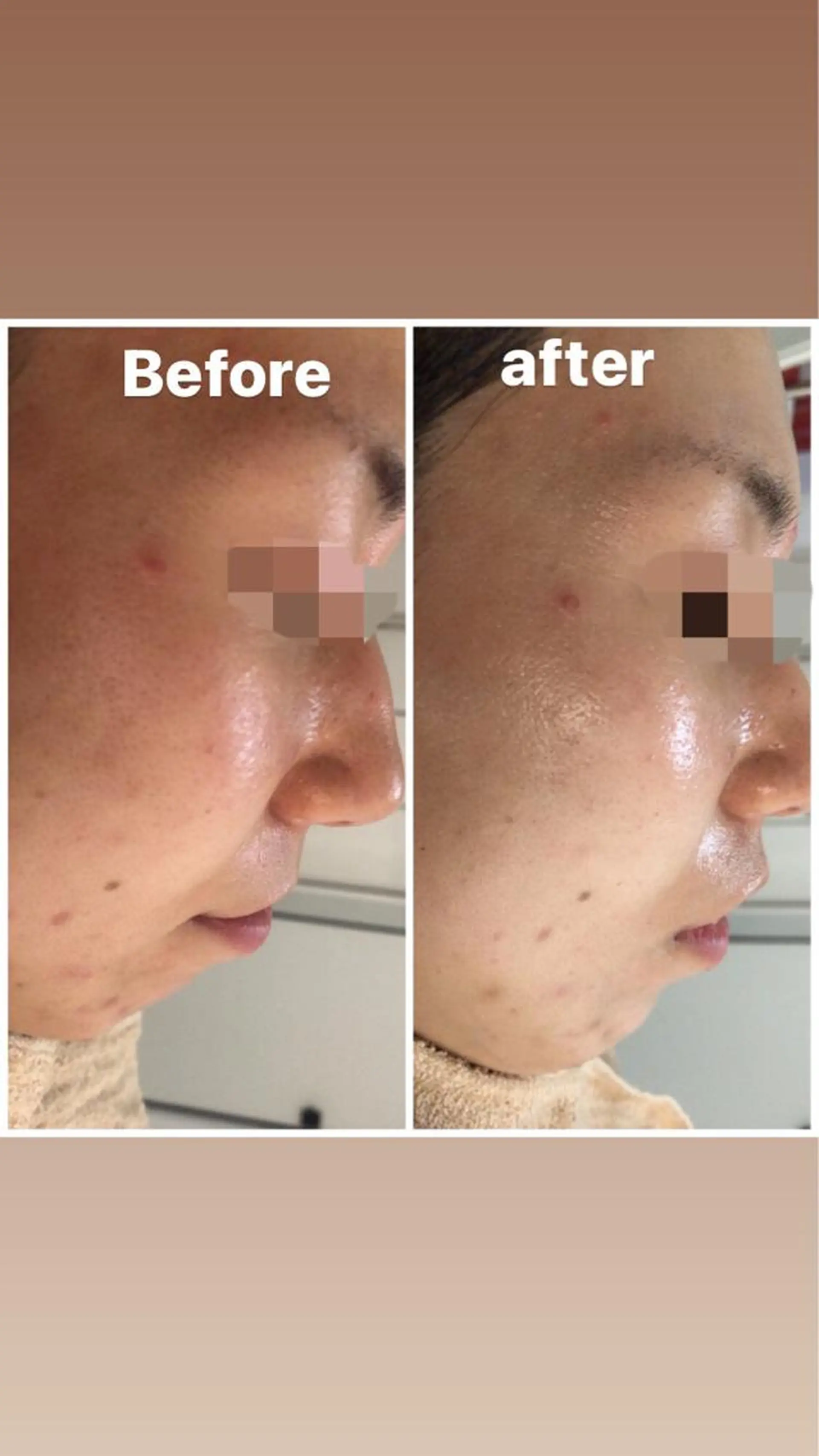 セミロング カラー パーマ ヘアアレンジ メンズ キッズ ネイル マツエク・マツパ Amaryllis 🌹のエステ・リラクイメージ