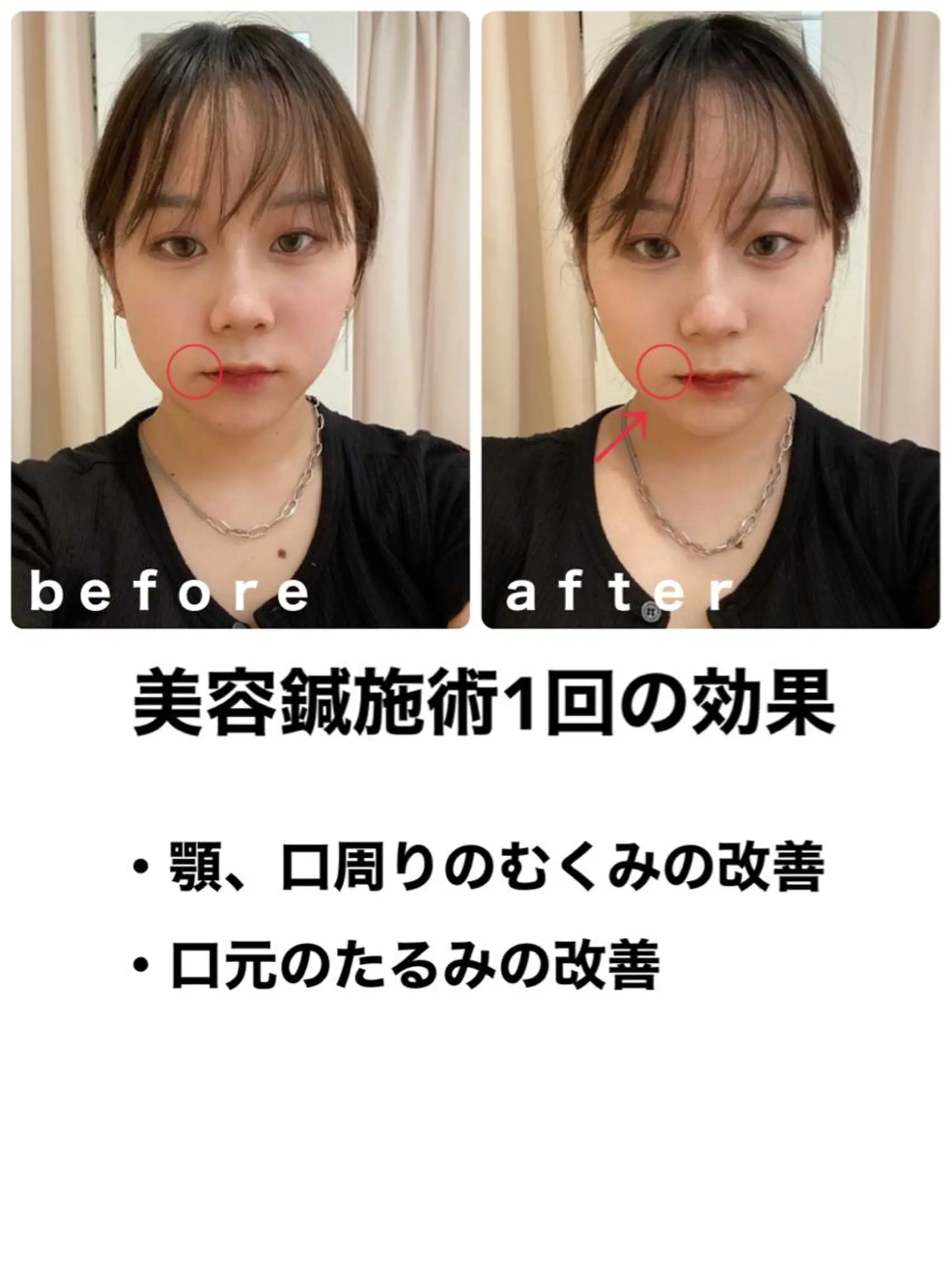 鍼灸 Refineのその他イメージ