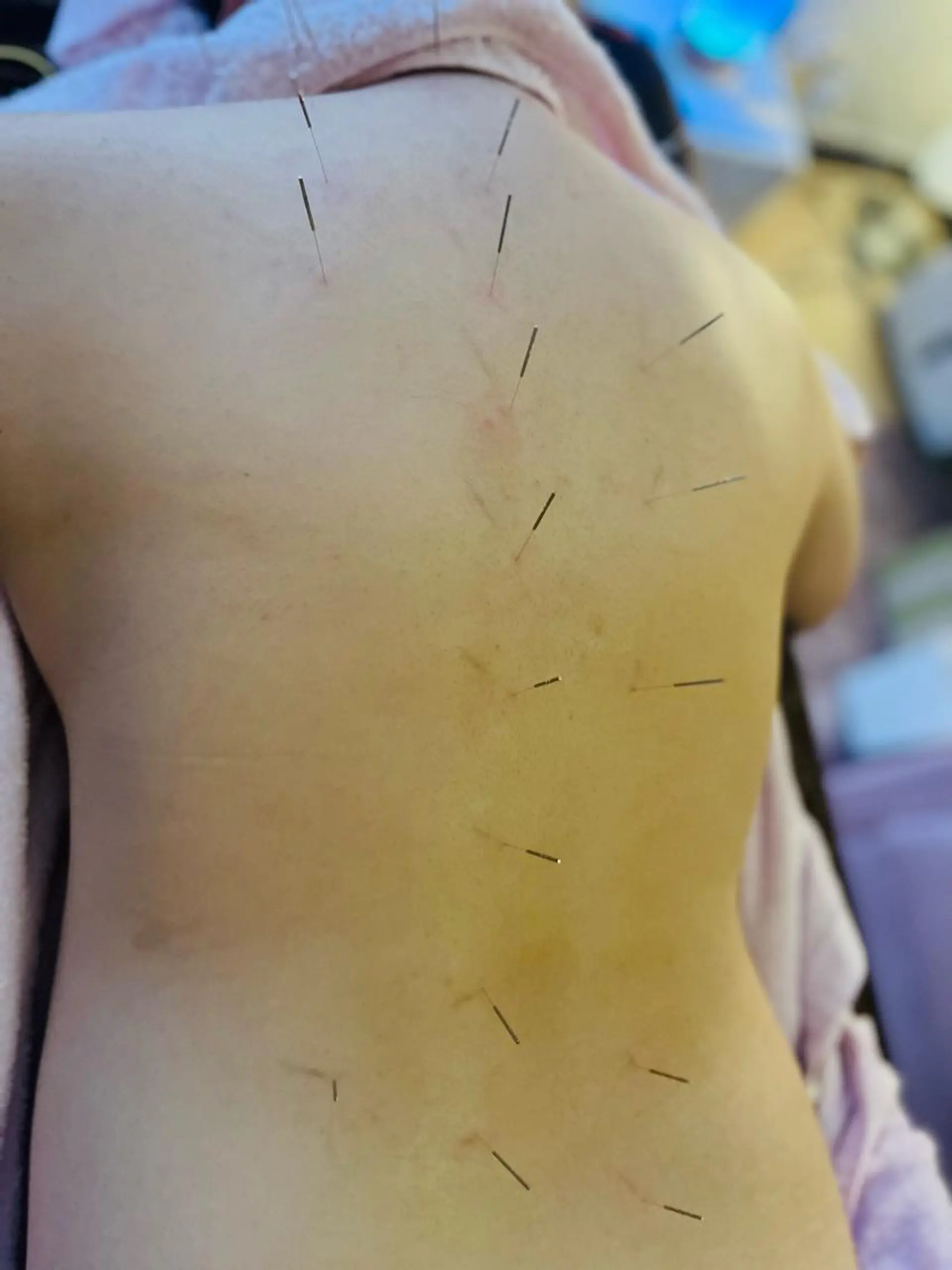 アロマ･美容鍼･カッ ピング「麗」鍼灸院のエステ・リラクイメージ