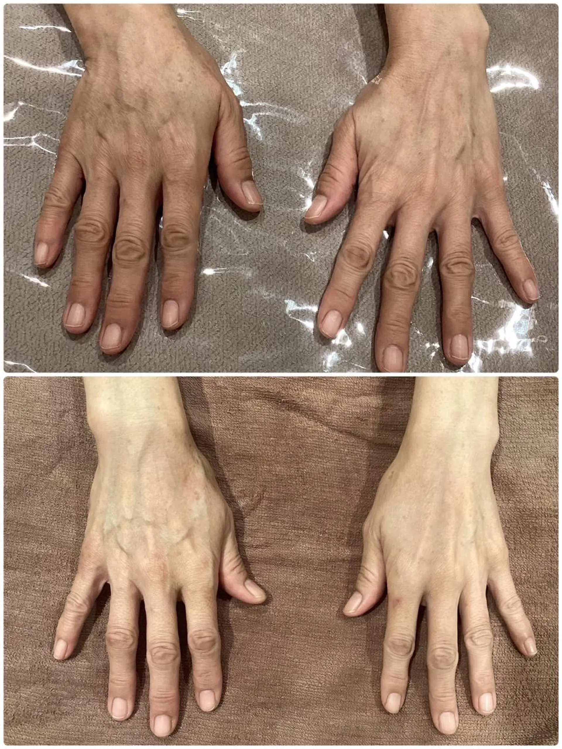 エステ 痩身脱毛専門店 Partirのエステ・リラクイメージ