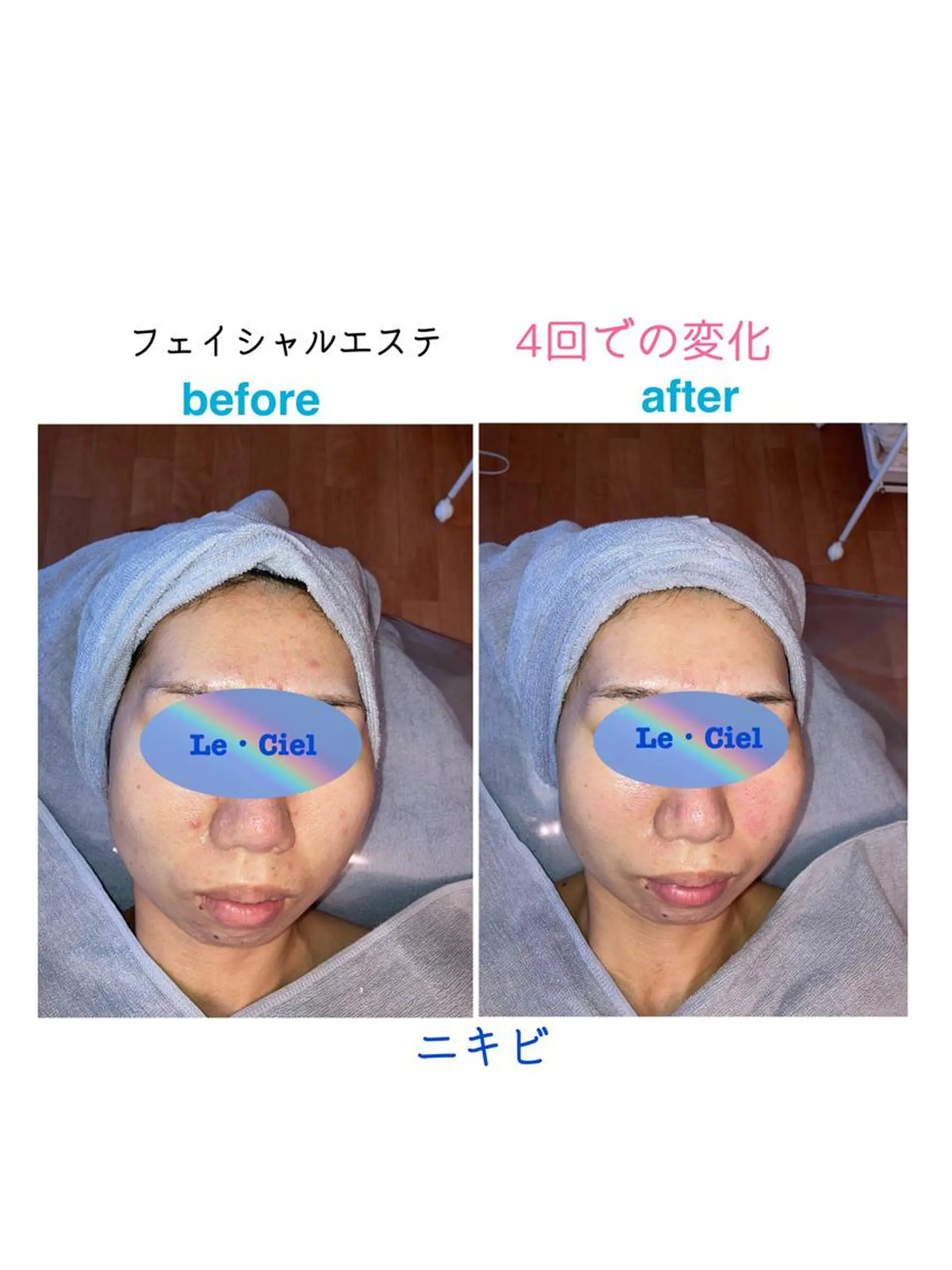 フェイシャルエステLe・Ciel所属・Le・Ciel フェイシャル&ボディのエステ・リラクイメージ