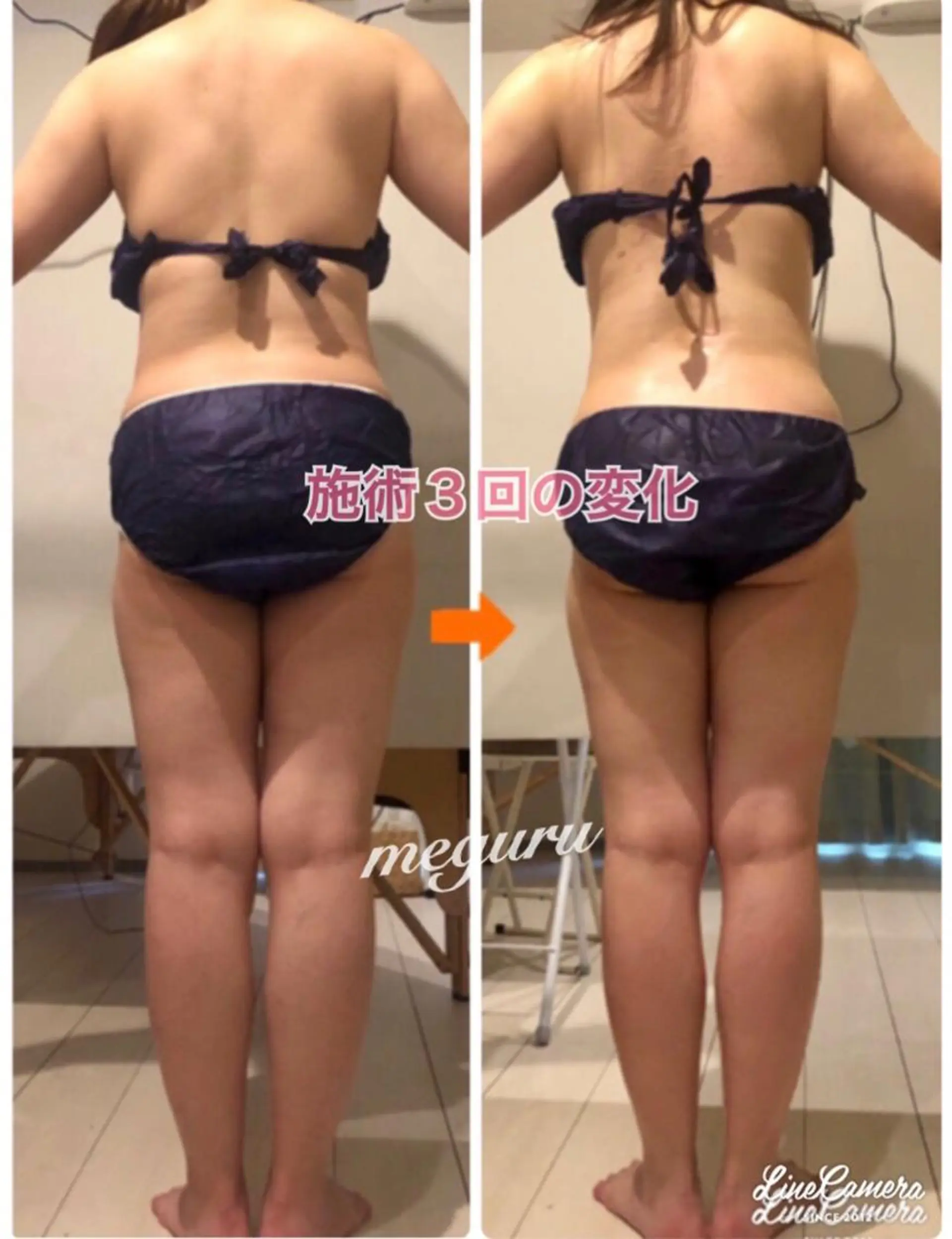 ショート カラー パーマ ヘアアレンジ メンズ キッズ ネイル マツエク・マツパ エステ リラク ‍痩身＆ボディ 結果出し🌟丹野のエステ・リラクイメージ