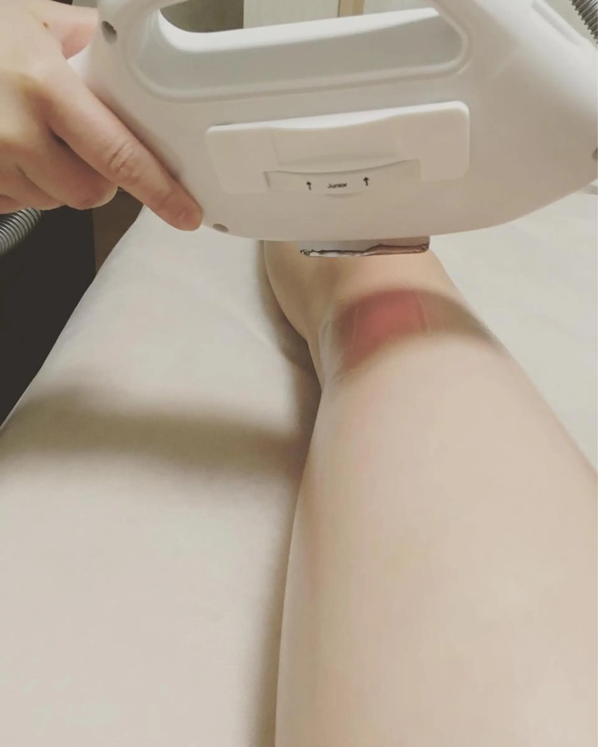 脱毛 A myのエステ・リラクイメージ