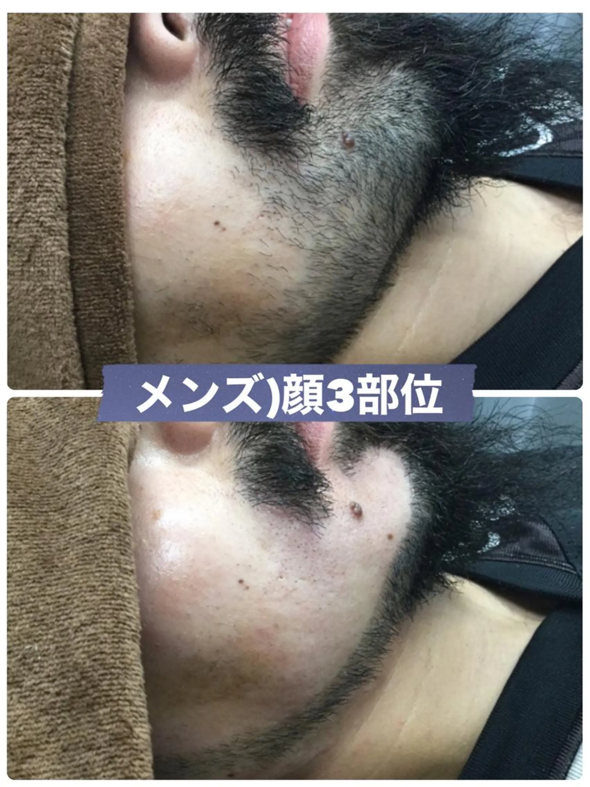 メンズ ブラジリアン☆WAX 🎖🌚YUKI🌚のエステ・リラクイメージ