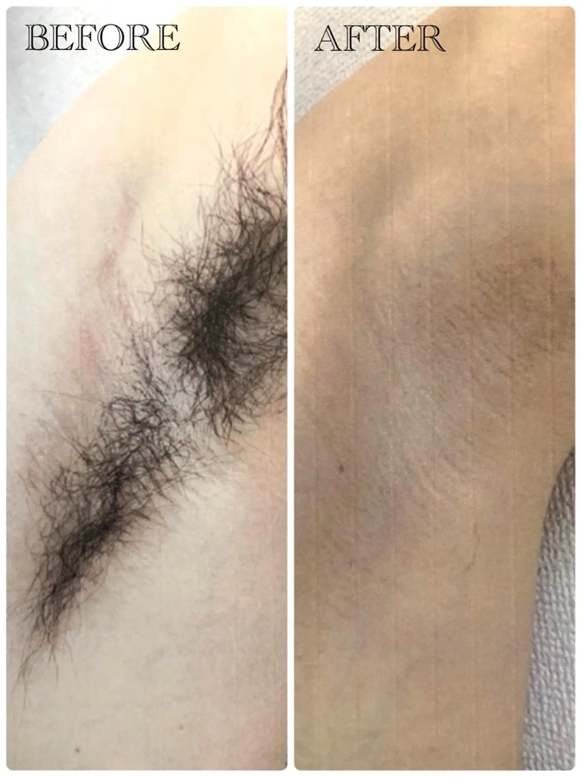 ❤️セルフ脱毛サロン jewel nailのエステ・リラクイメージ