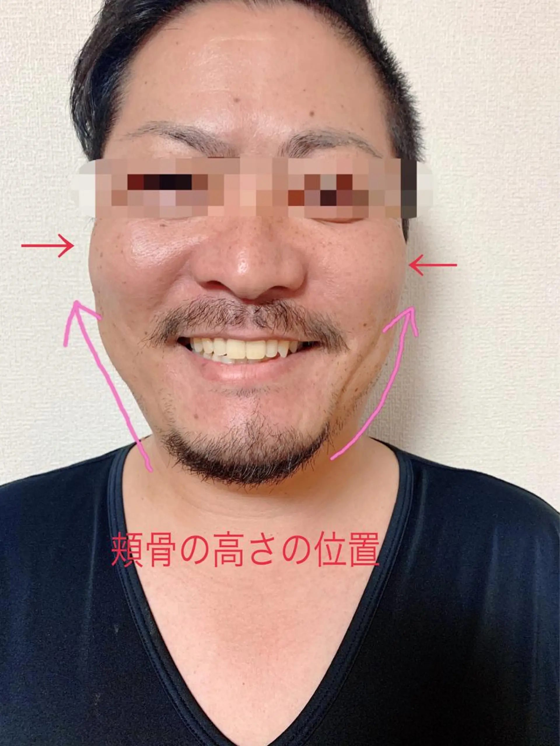 痩身/脱毛/ネイル HARUKAのエステ・リラクイメージ