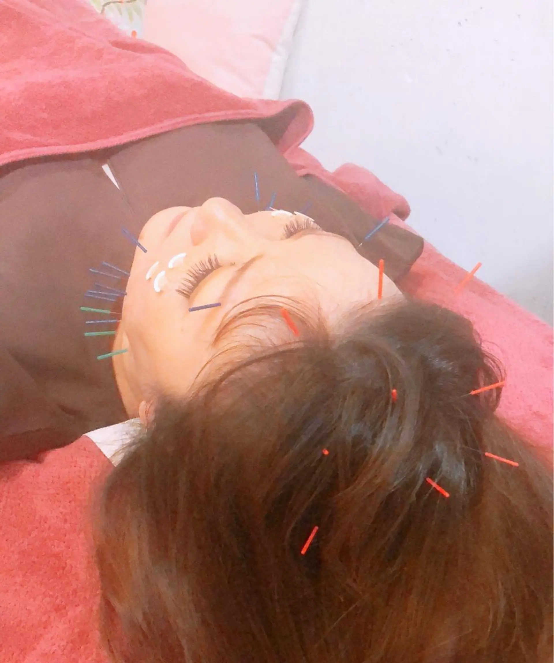 美容鍼灸女性専用 りんご鍼灸治療院のその他イメージ