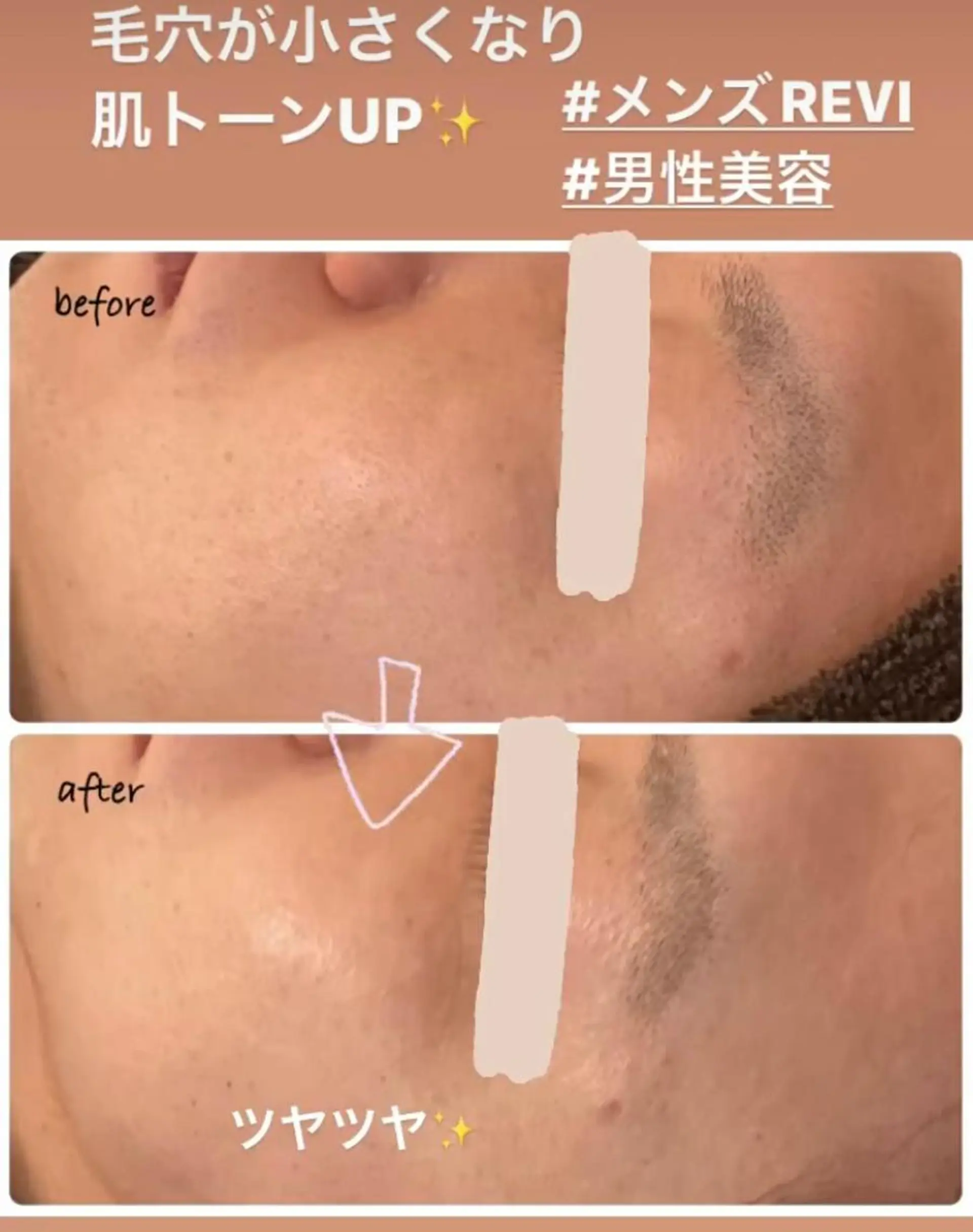 エステ luana beauty所属・kana ハーブピーリング🌿のエステ・リラクイメージ