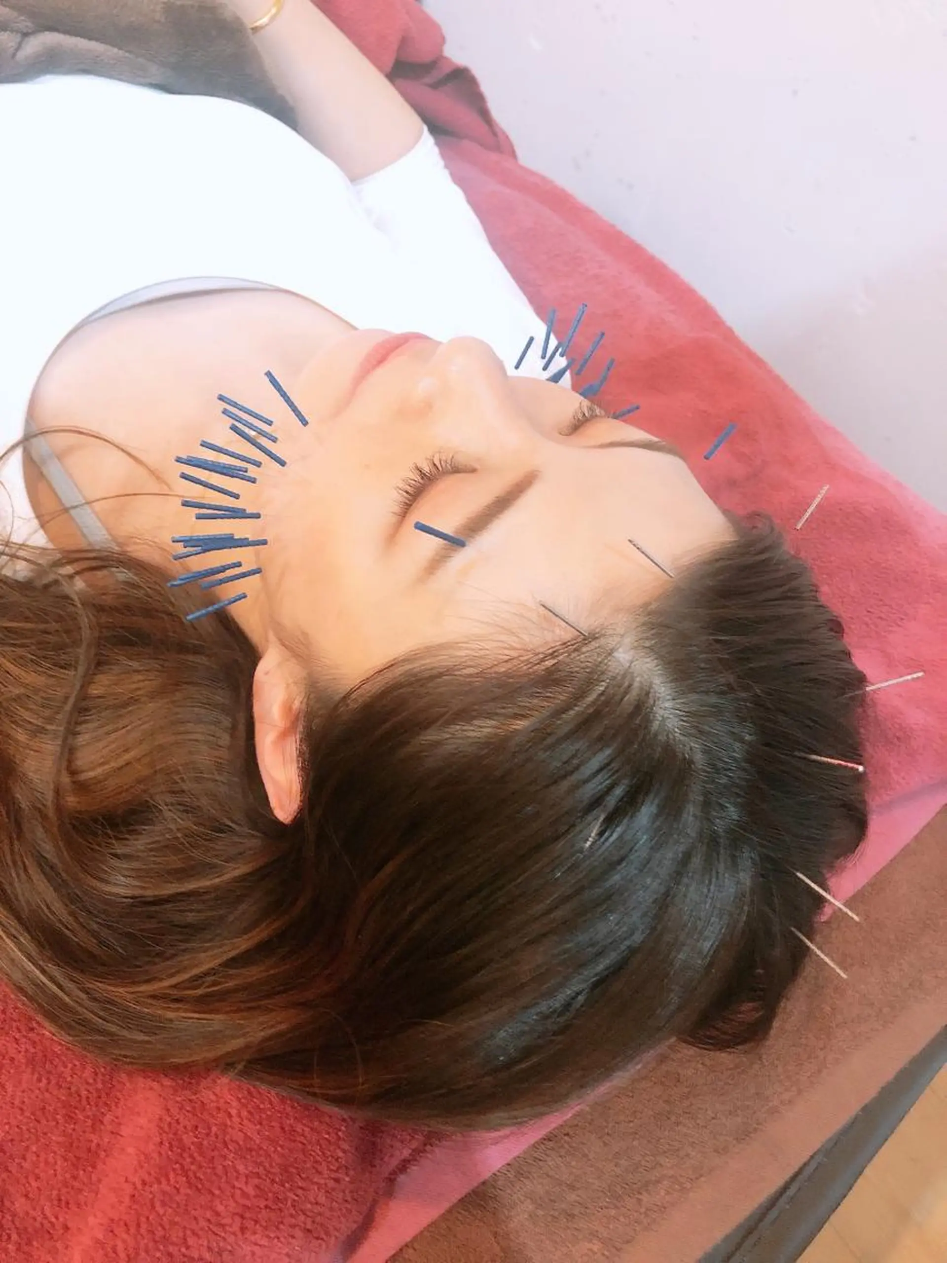 エステ リラク 美容鍼灸女性専用 りんご鍼灸治療院のその他イメージ