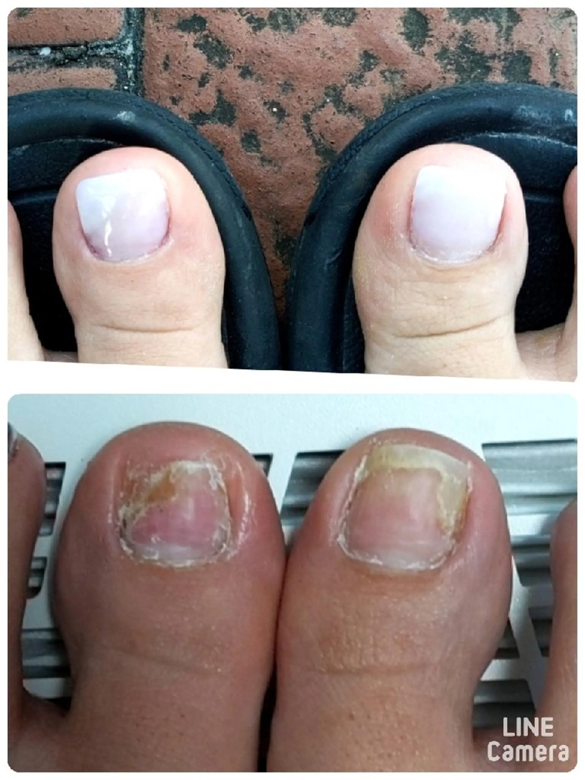 ネイル フットネイル yuu -joynailのネイルデザイン