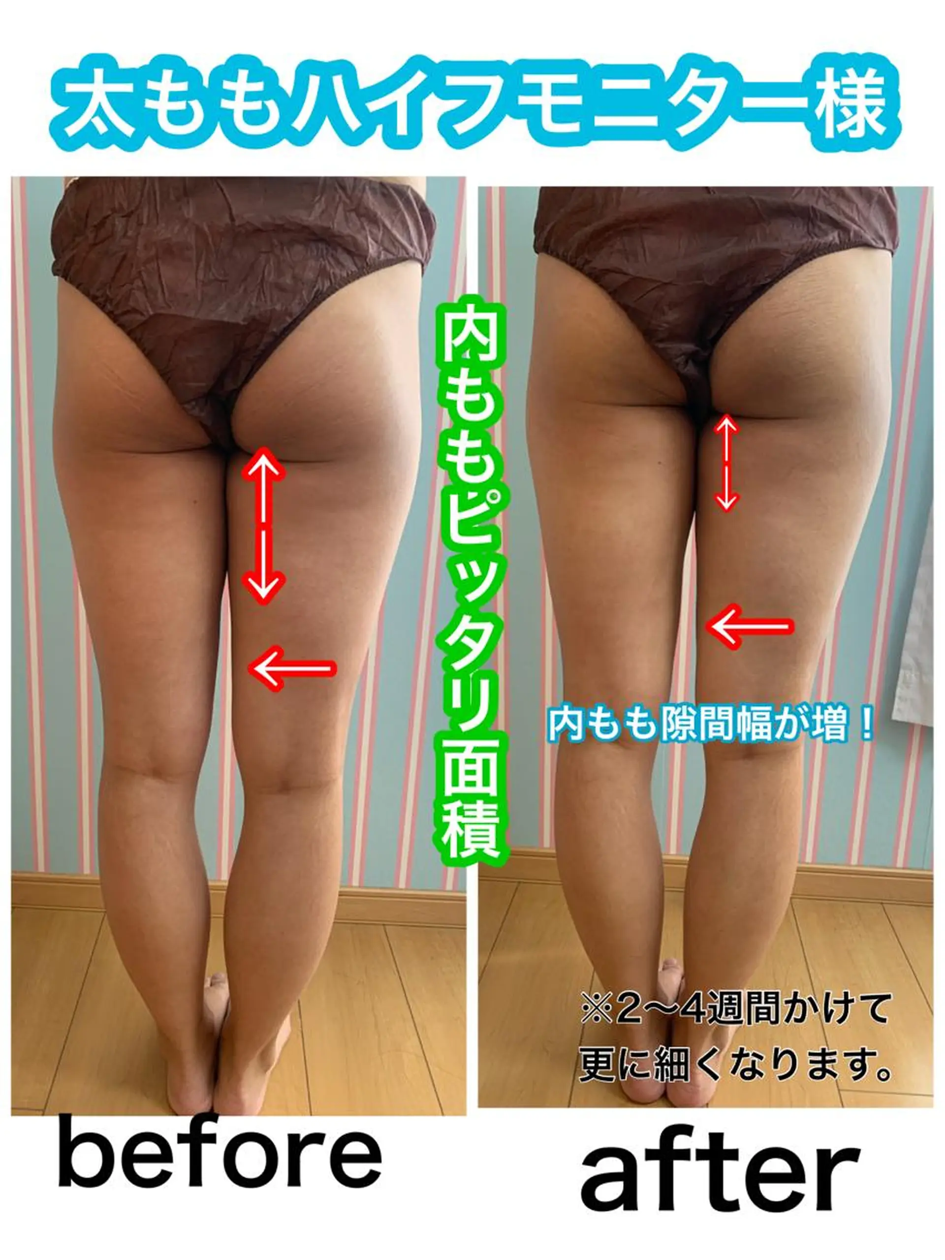 痩身/脱毛/ネイル HARUKAのエステ・リラクイメージ