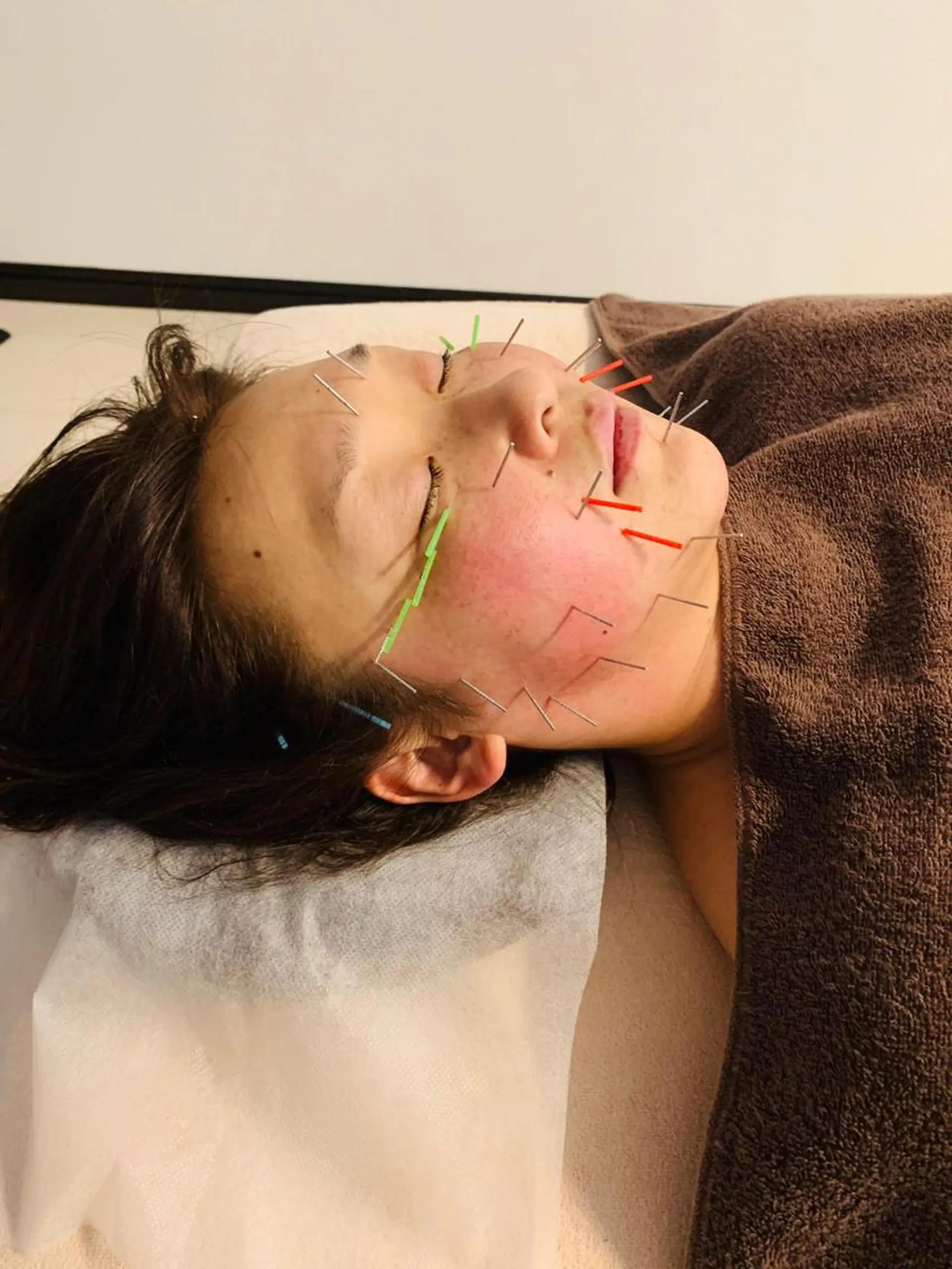 鍼灸院 Fleuretteのエステ・リラクイメージ