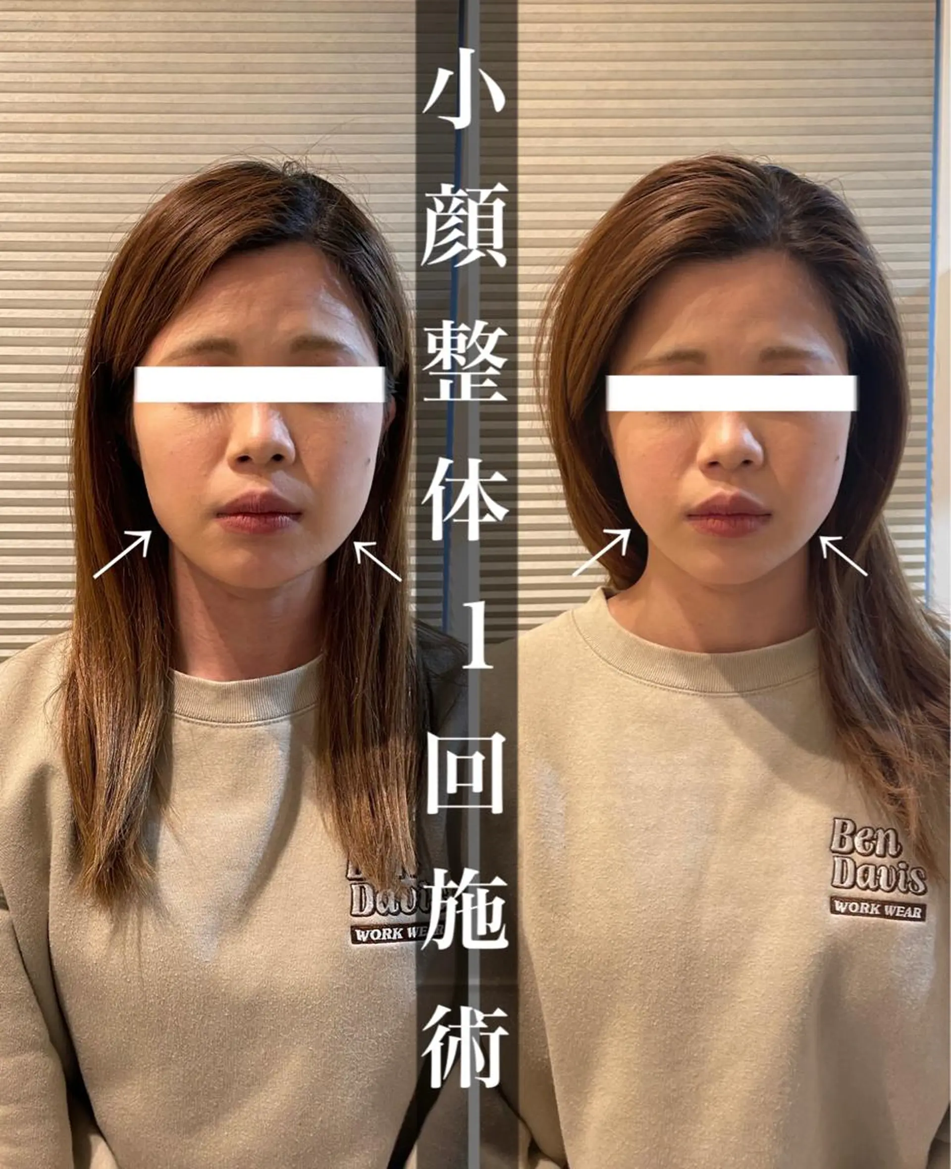 鍼灸 Refineのその他イメージ