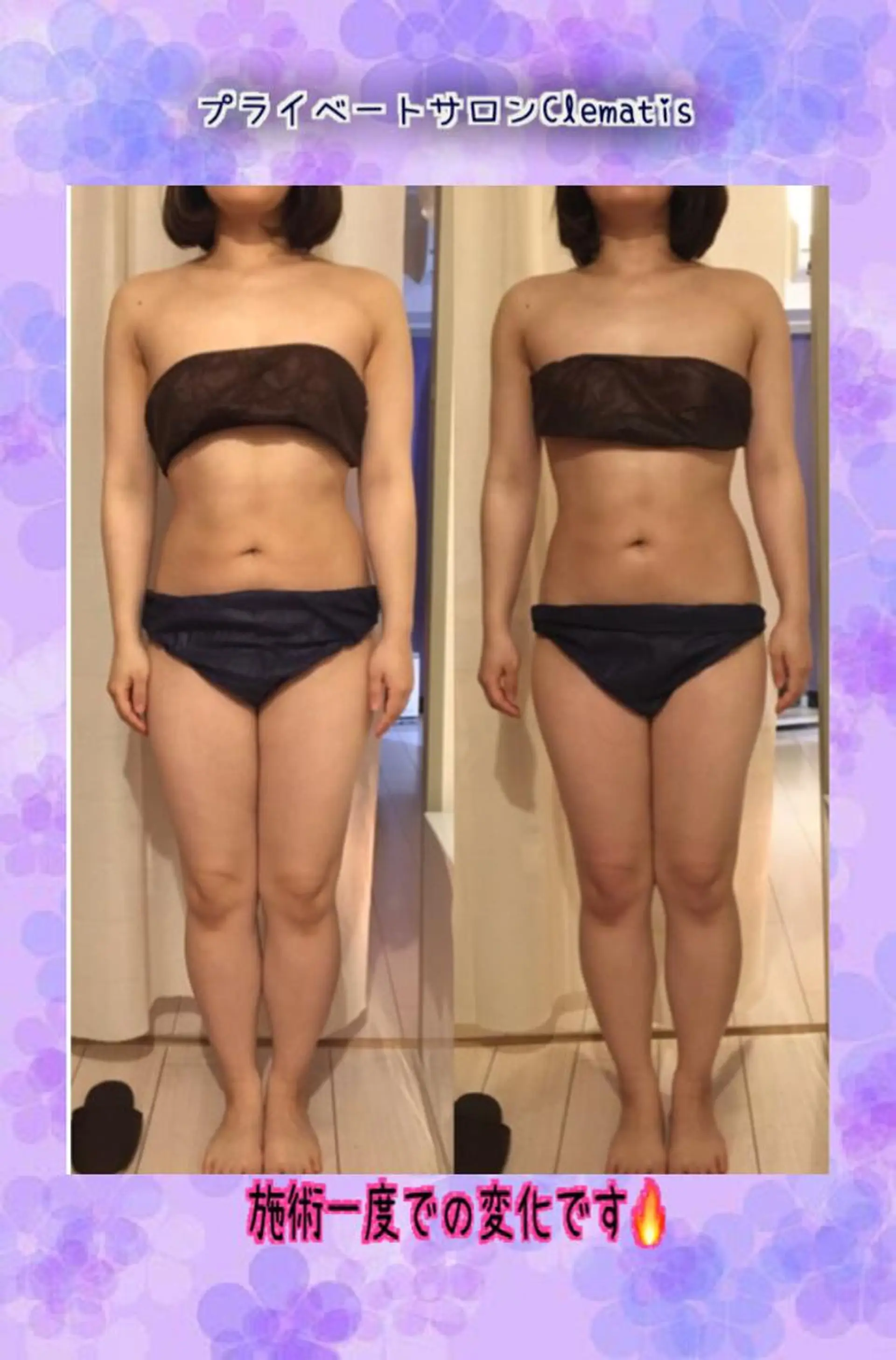 ショート カラー パーマ ヘアアレンジ メンズ キッズ ネイル マツエク・マツパ 強圧オールハンド痩身 片野のエステ・リラクイメージ