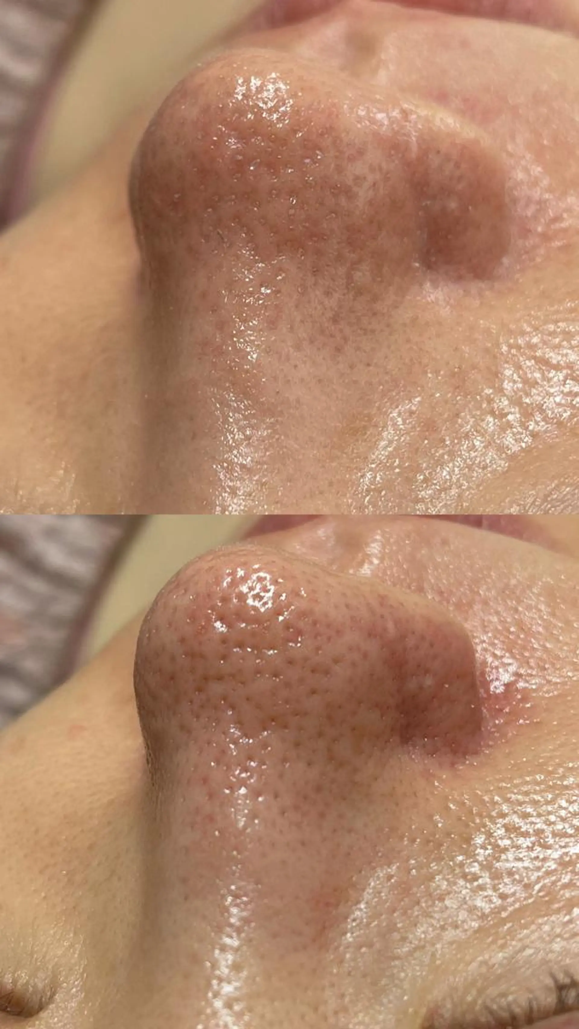 Lilyboo 多田のエステ・リラクイメージ