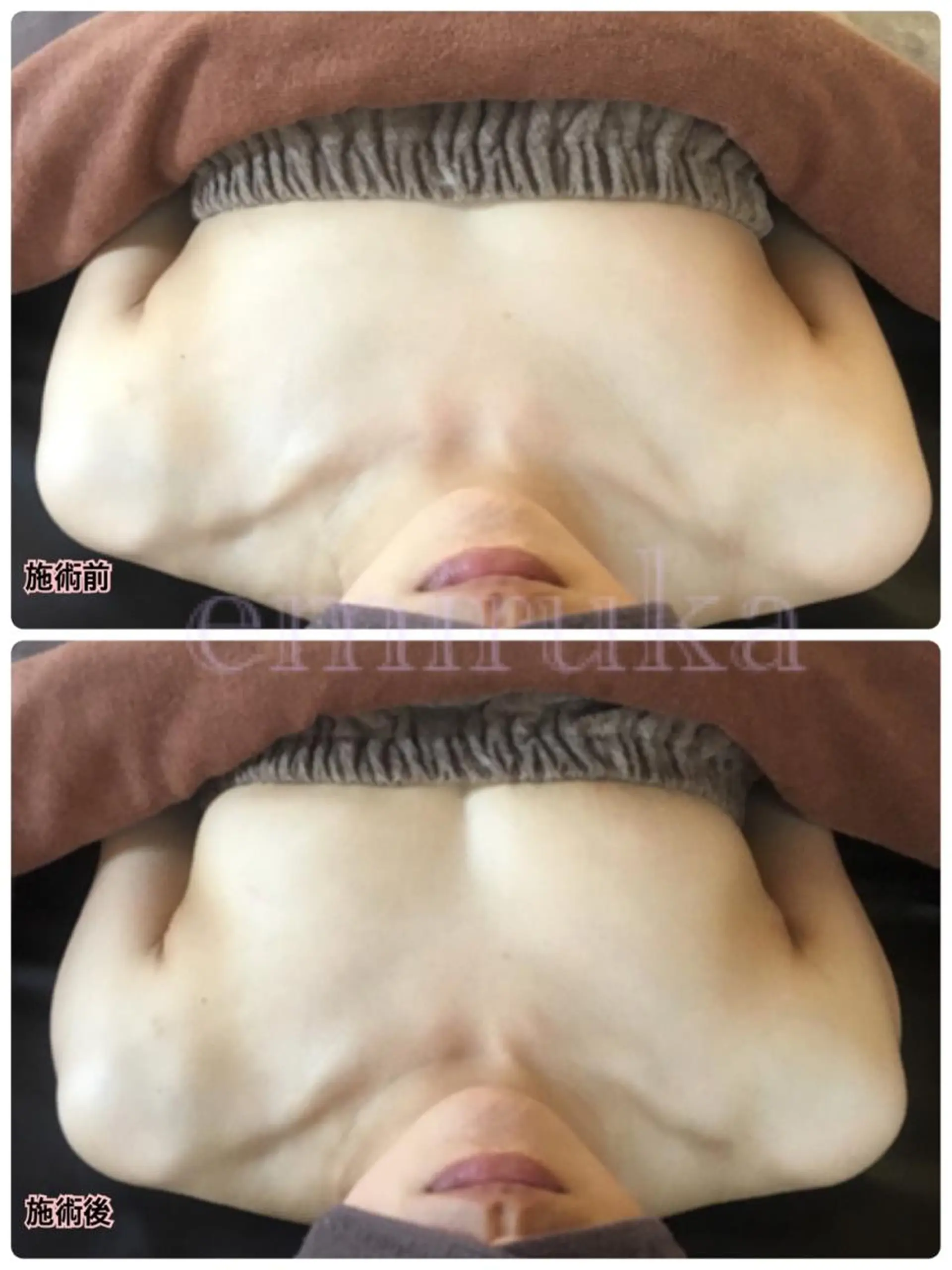 バストアップサロン エミルカのその他イメージ