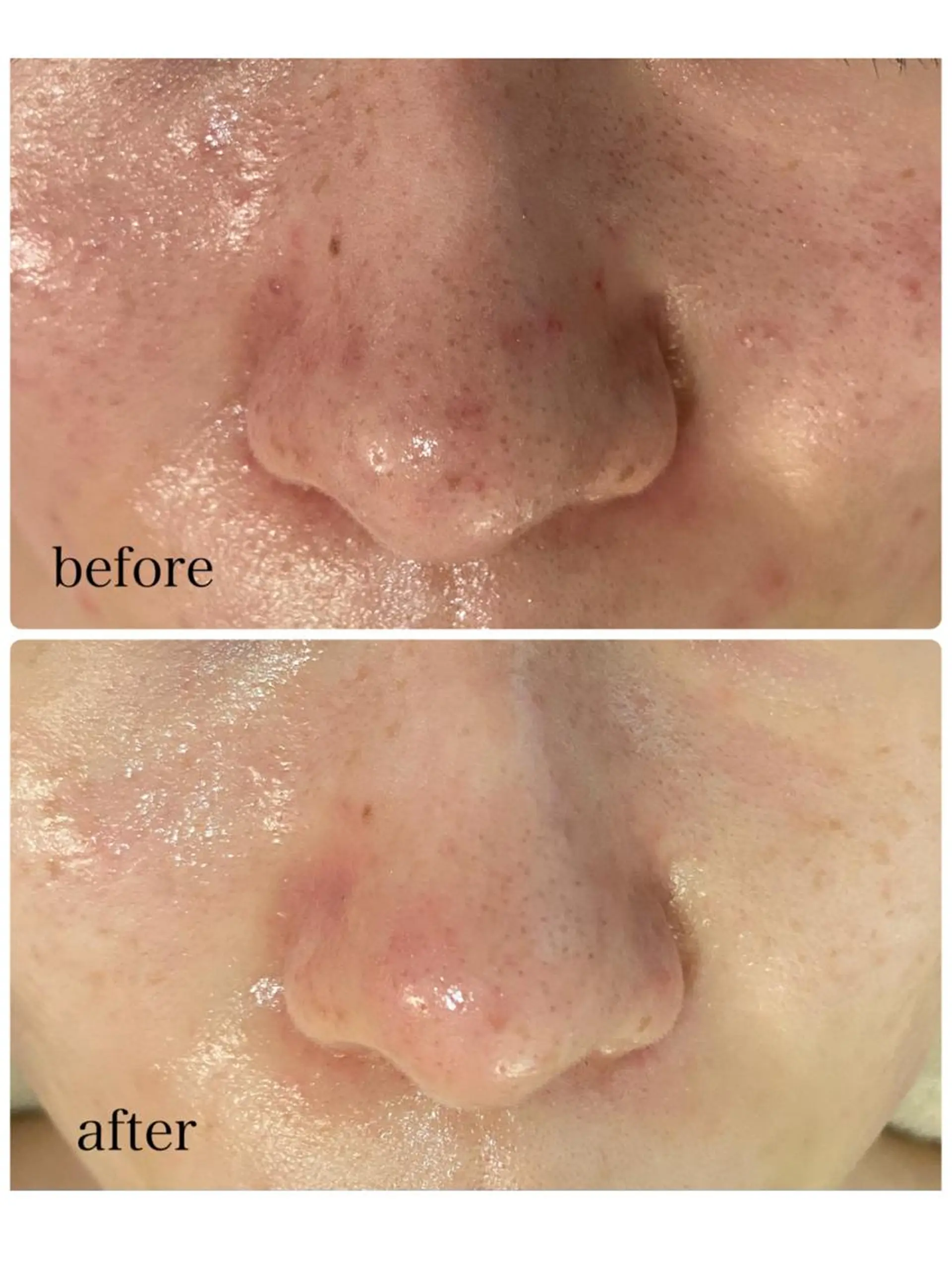 毛穴・シミ専門サロン ルパークのエステ・リラクイメージ