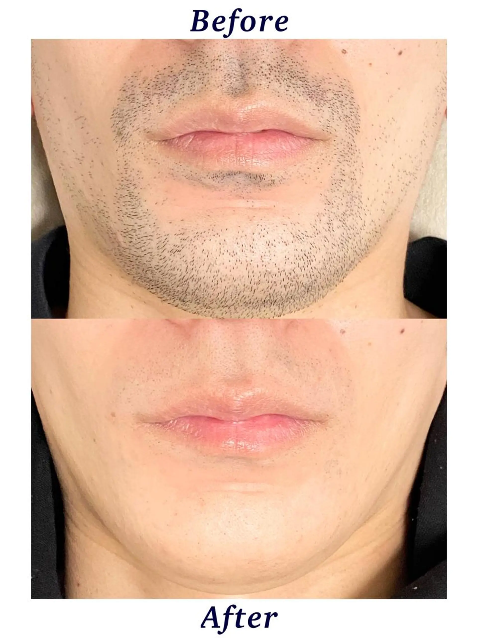 メンズ 🔹Lonie🔹 Yudaiの眉毛・アイブロウイメージ