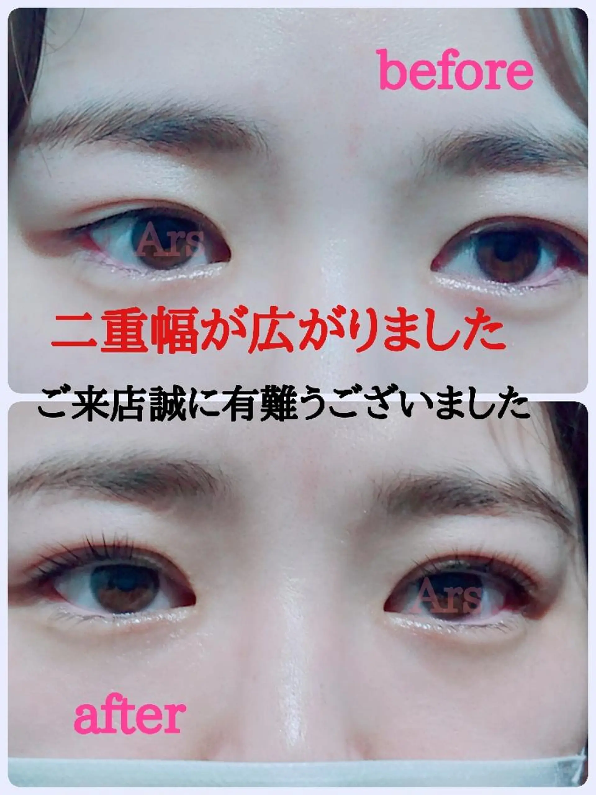 メンズ マツエク・マツパ メンズパーマ アイリッドアップパーマ Ars      (ｱﾙｽ)のマツエク・マツパデザイン