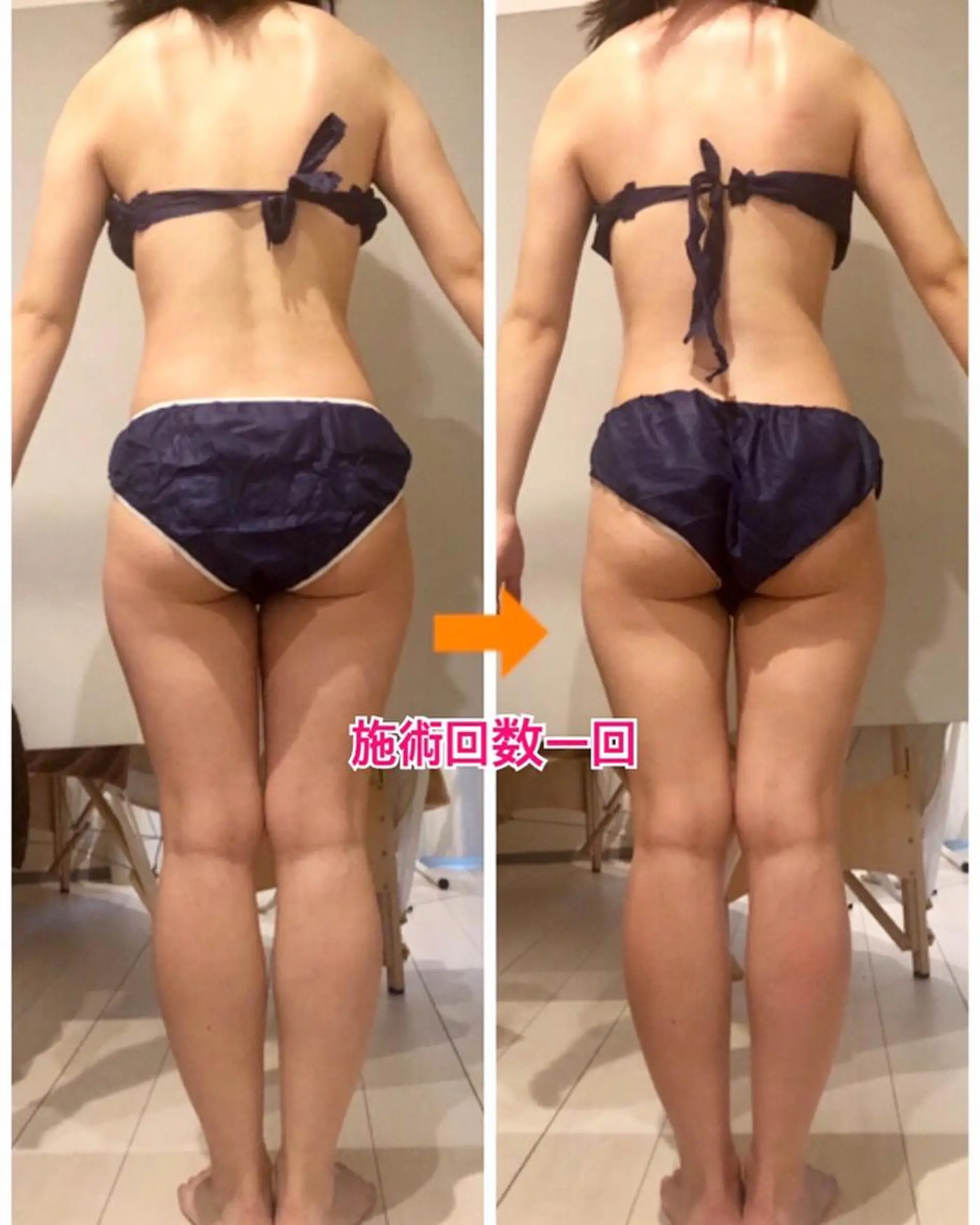 ショート カラー パーマ ヘアアレンジ メンズ キッズ ネイル マツエク・マツパ ‍痩身＆ボディ 結果出し🌟丹野のエステ・リラクイメージ