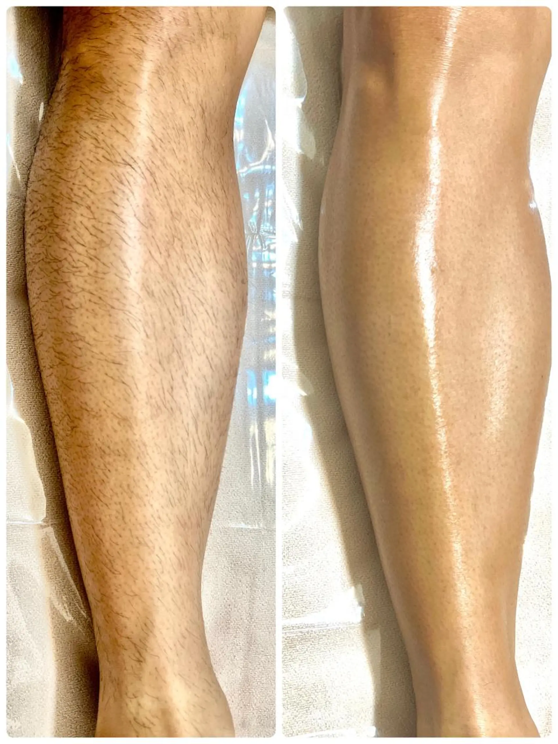 メンズ 枚方市香里園脱毛 サロンCHICIELのエステ・リラクイメージ