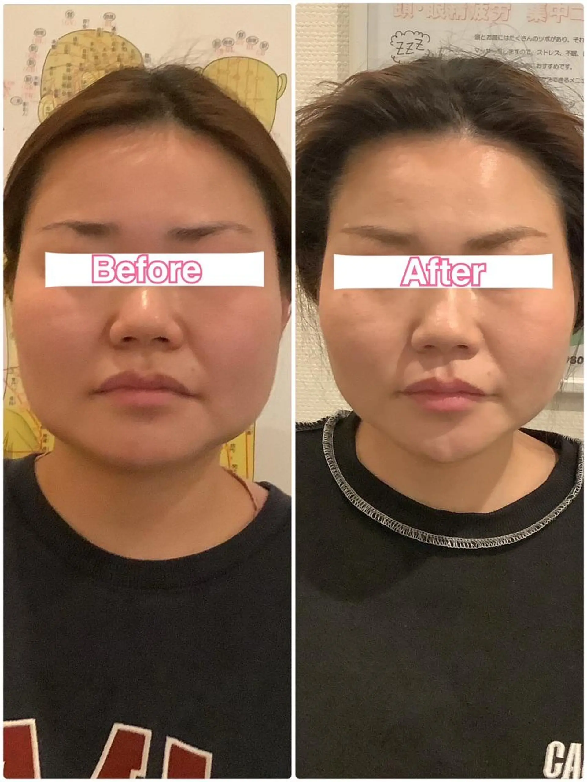 エステ リラク 美容鍼・整体サロン アネモネ🌸心斎橋のエステ・リラクイメージ