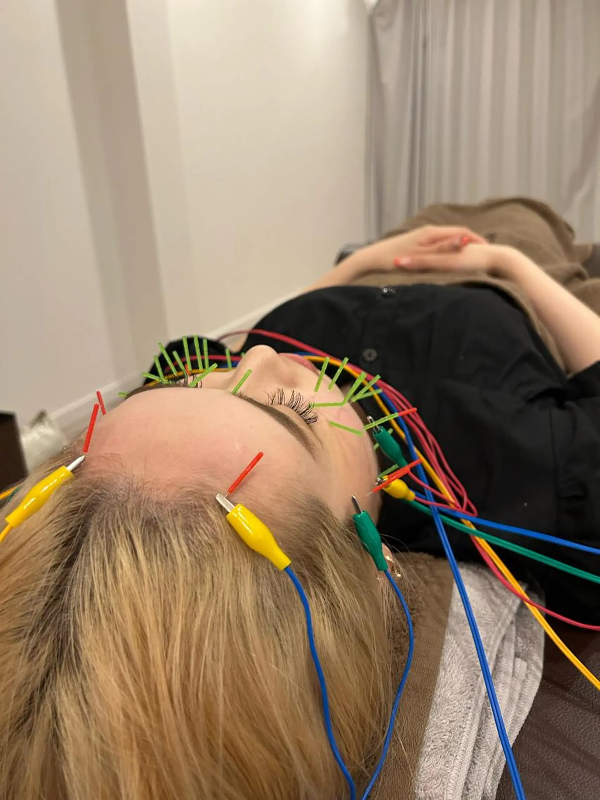 エステ リラク 肌質改善×美容鍼 ゆいのエステ・リラクイメージ