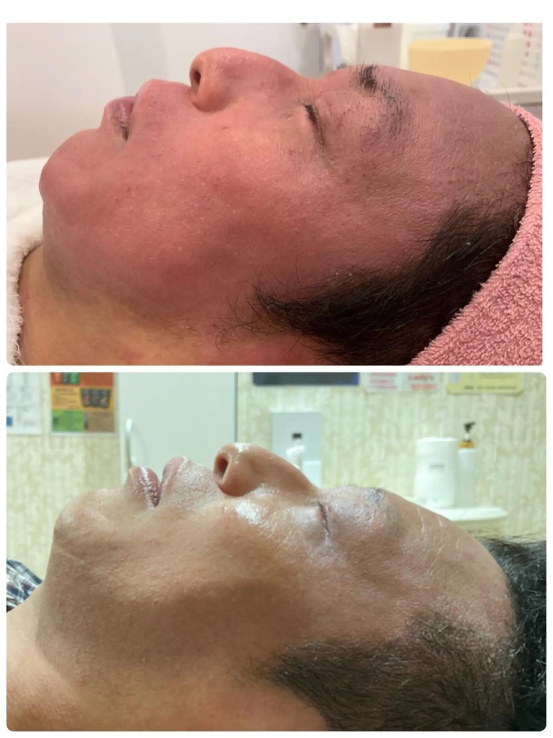 フェイシャル/脱毛 ジョアアンジェ　田中のエステ・リラクイメージ