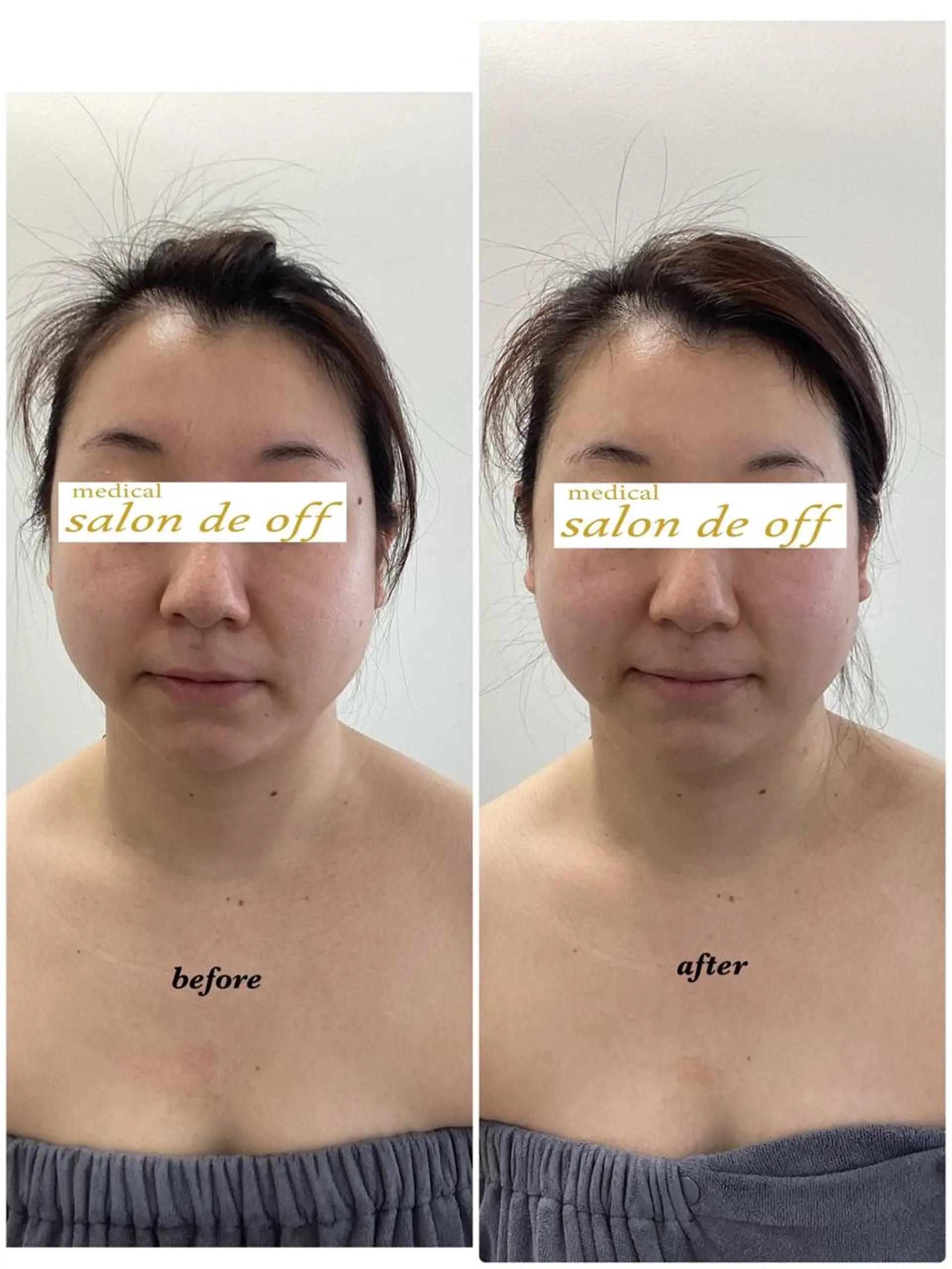 エステ リラク メディカルサロンドオフ所属・ハリサロンドオフ 美容鍼灸×小顔整体のエステ・リラクイメージ