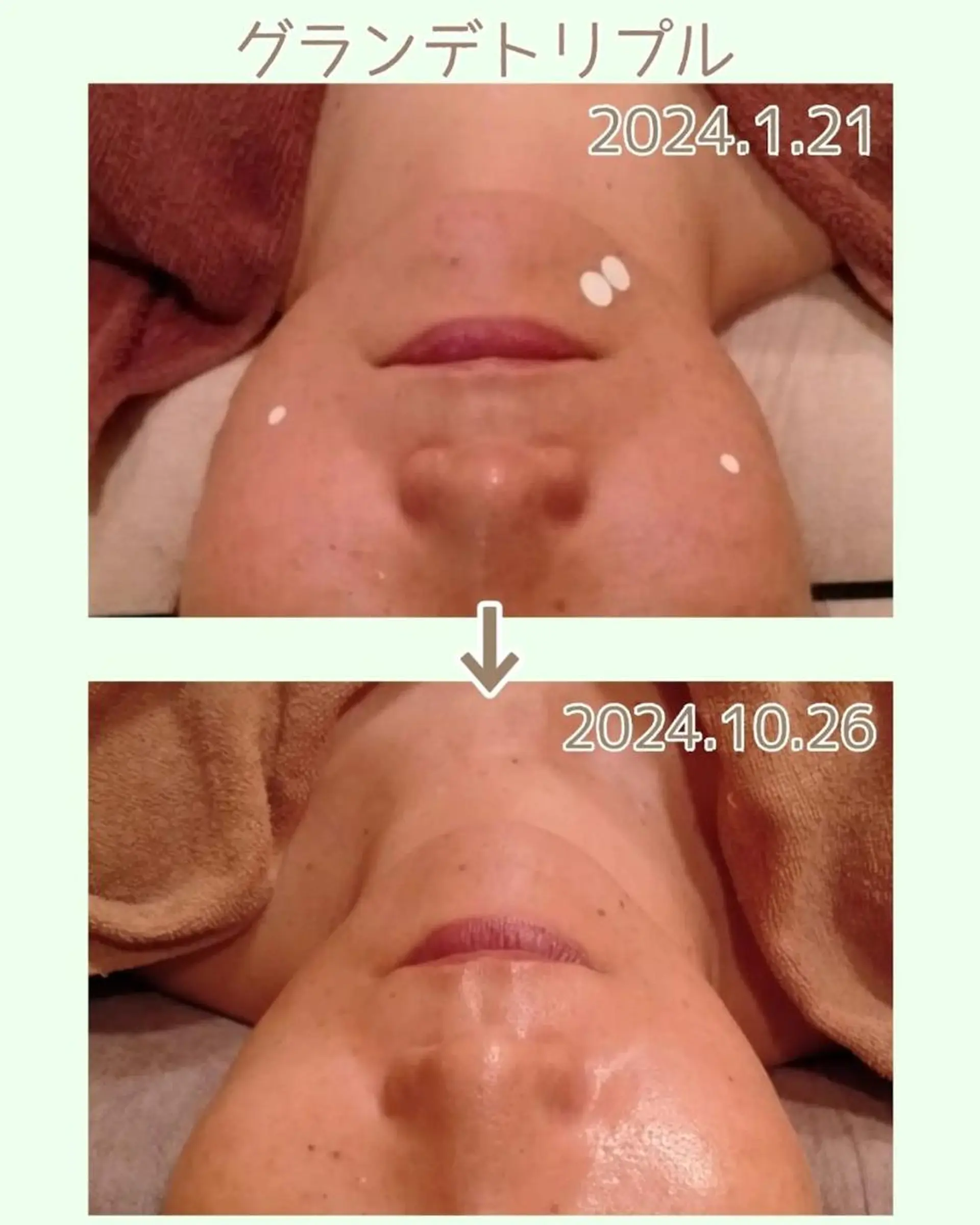 ラブニール 恵比寿店のエステ・リラクイメージ