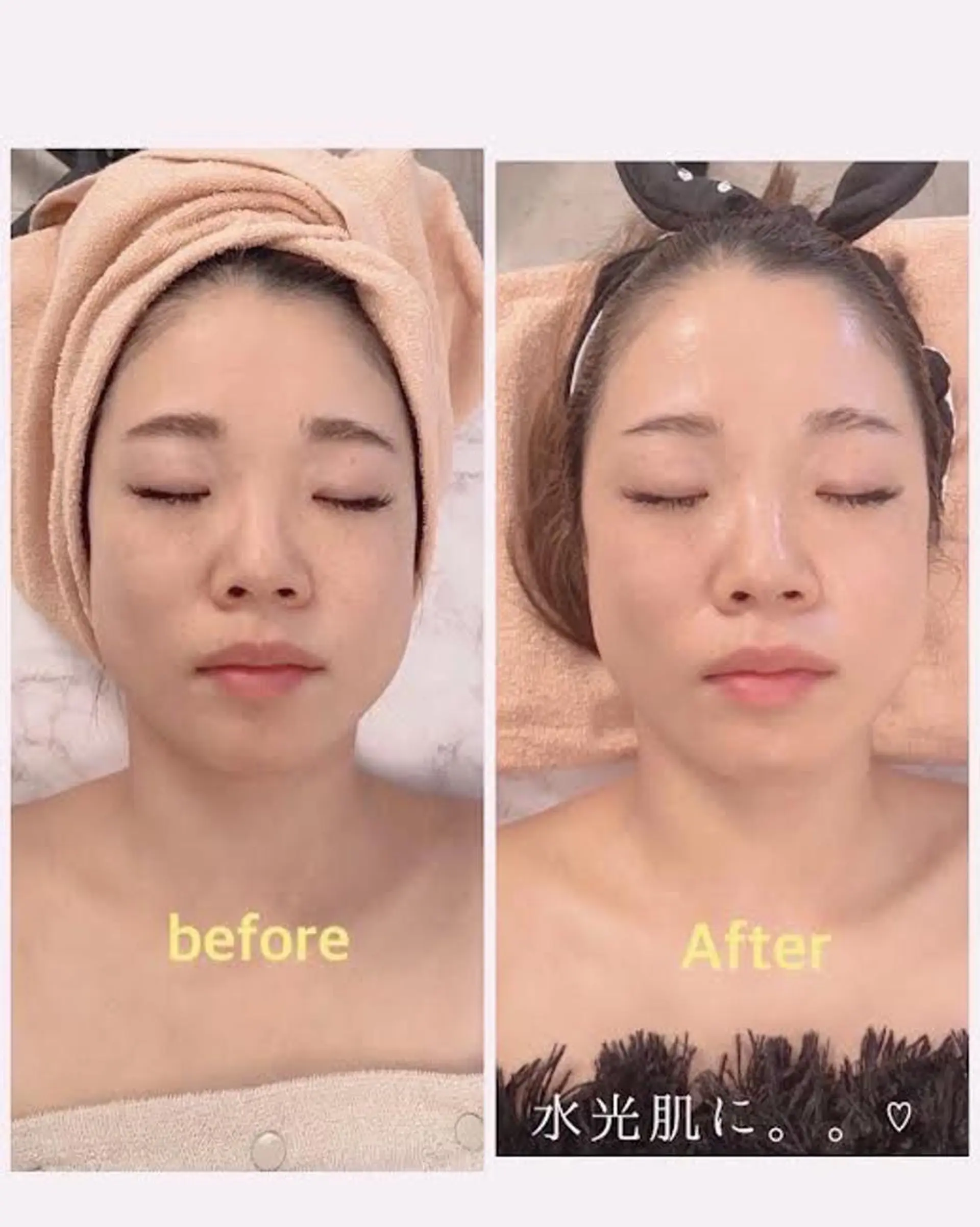 エステ 福留 千春のその他イメージ