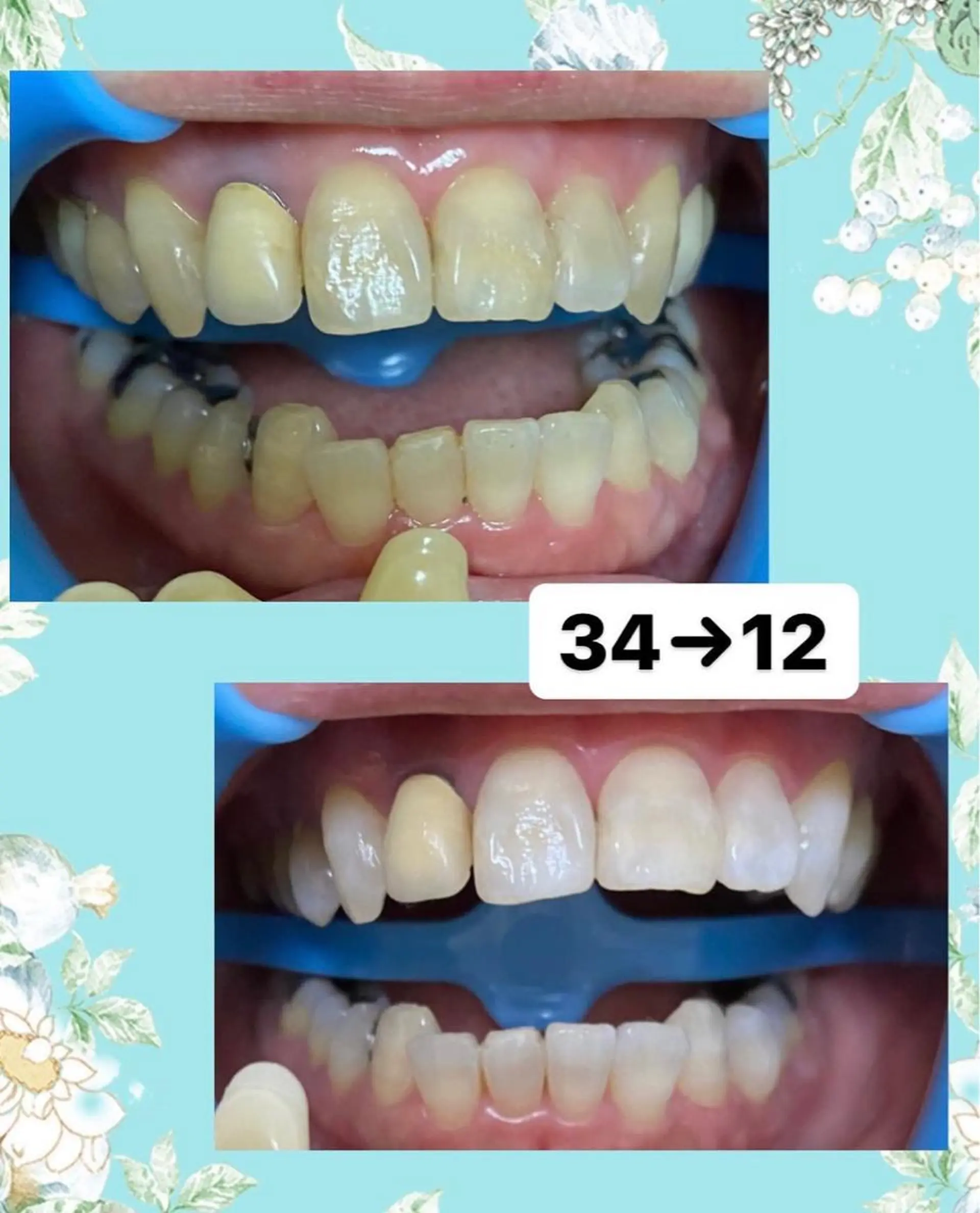 その他 DIA WHITE 奥田のその他イメージ