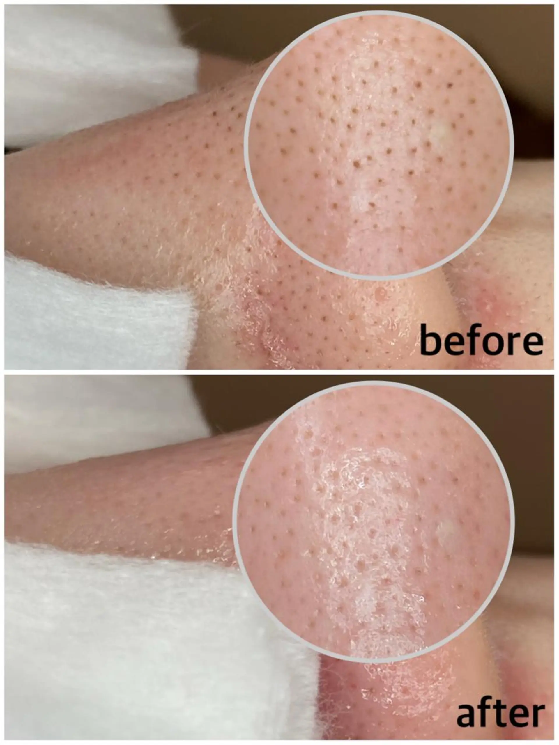 マツエク・マツパ エステ リラク 韓国肌管理 【毛穴専科】のエステ・リラクイメージ