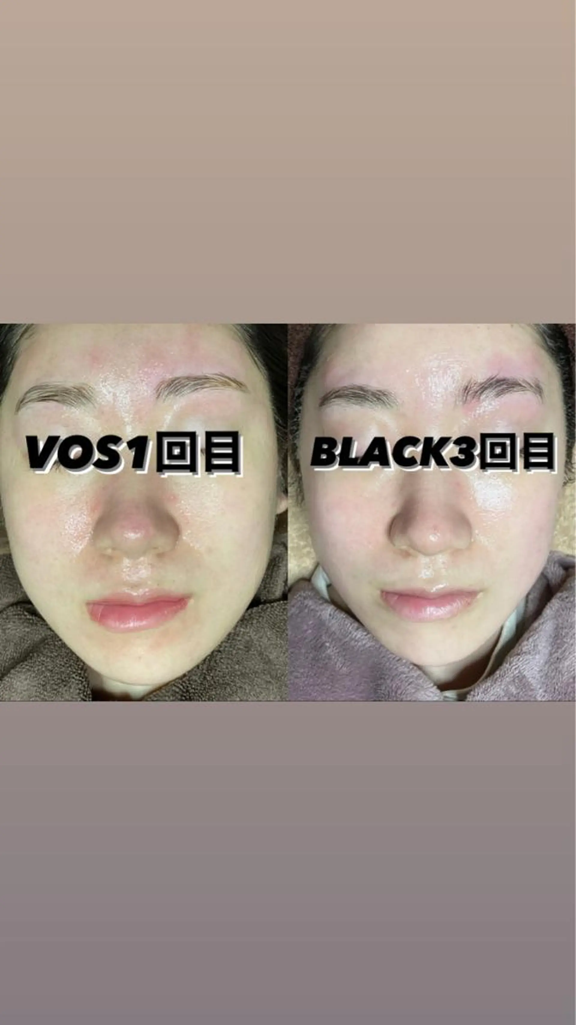 代表 MOMOのエステ・リラクイメージ