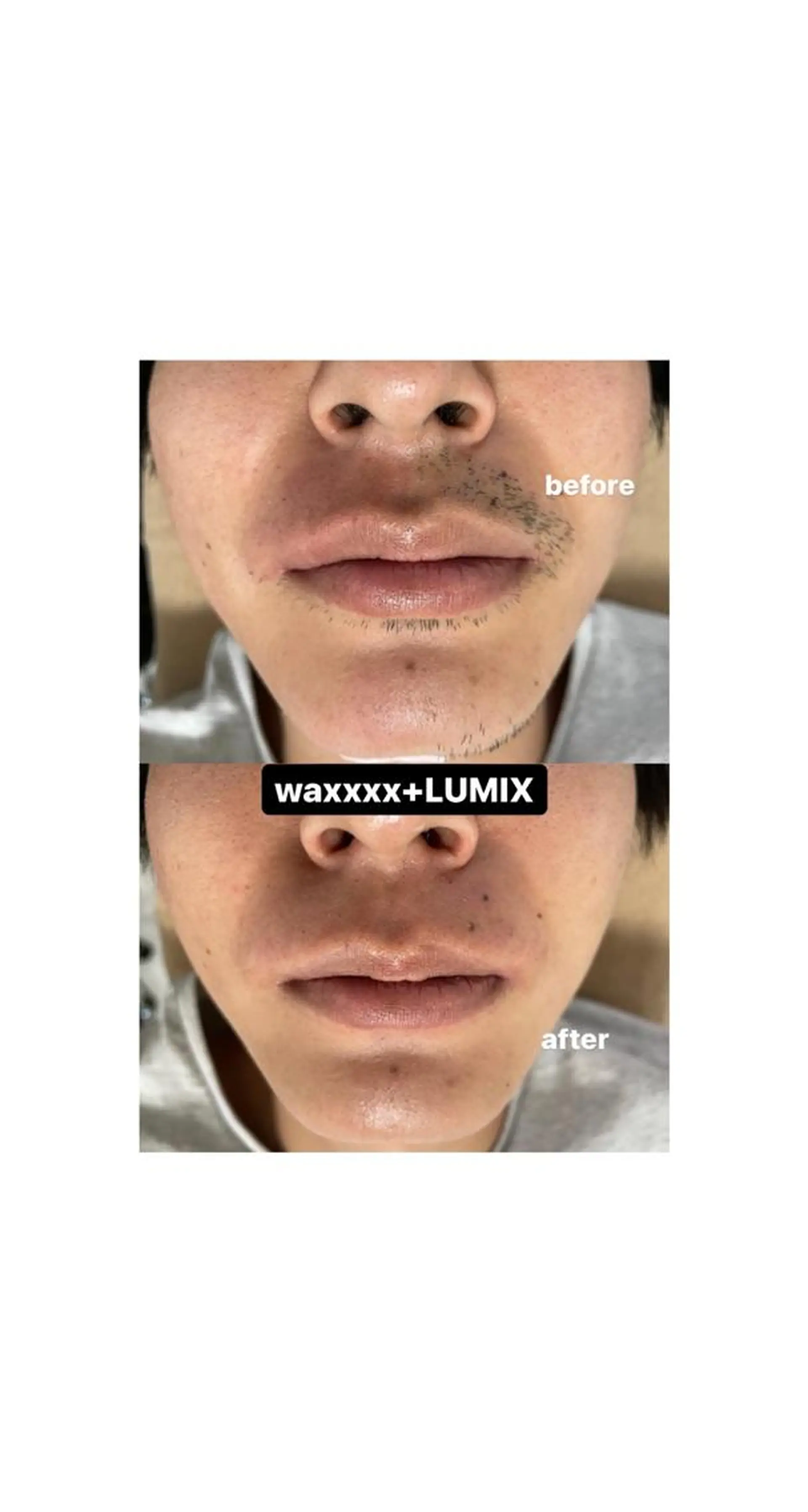 脱毛 Epina 千葉店 【エピナ】のエステ・リラクイメージ