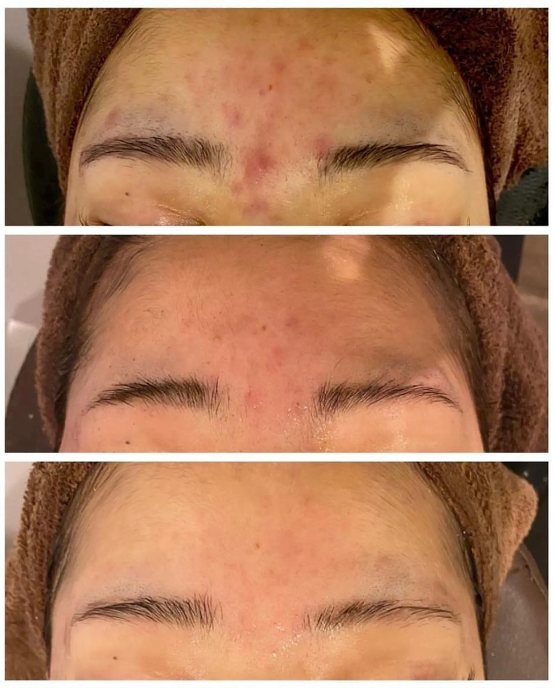 本気の肌質改善スキン デトックス🌿のエステ・リラクイメージ